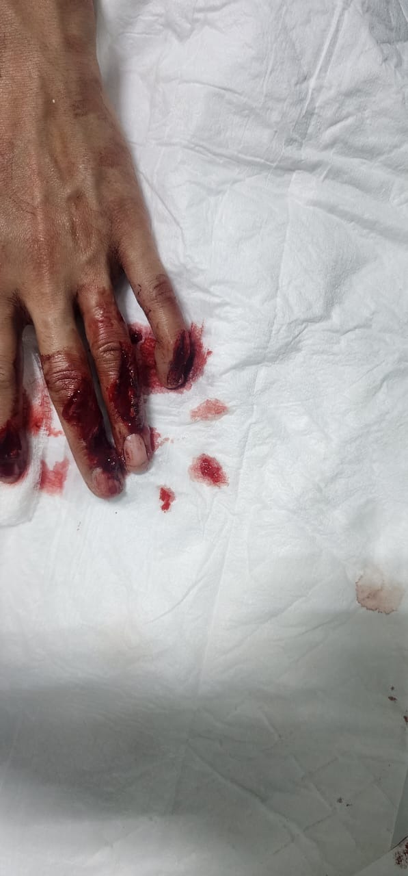 Help Iliana Recover from Her Hand Surgery campaign photo, 4 of 5