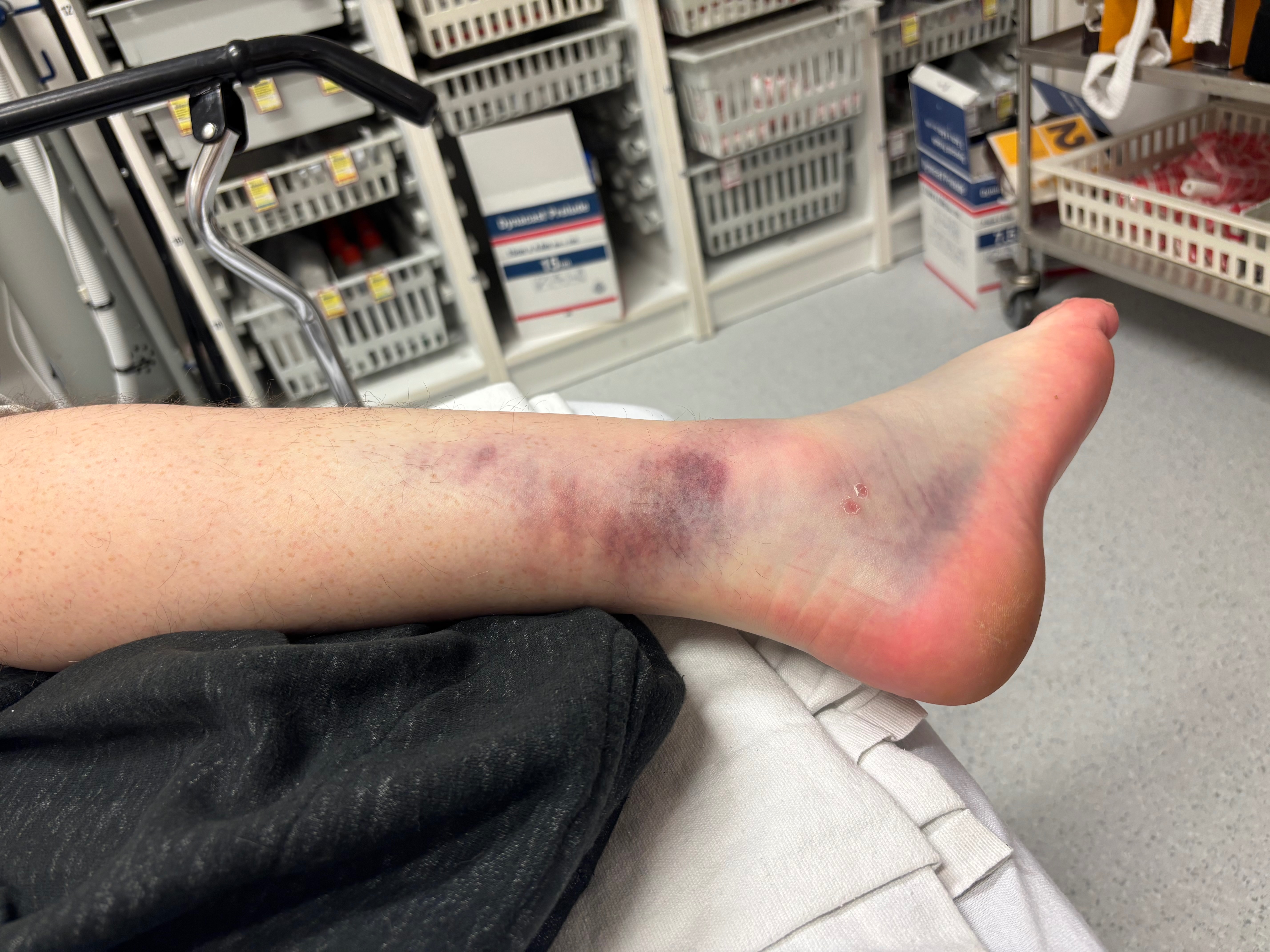 Split Second Changed Everything-Help to Get Back on My Feet campaign photo, 4 of 6