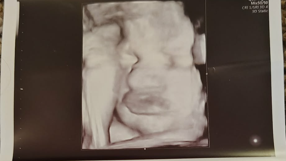 Help Samantha Welcome Her Miracle Baby photo