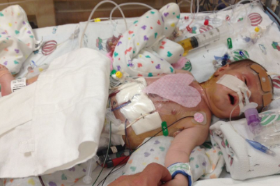 Urgent Surgery for Baby Nelly’s Heart campaign photo, 4 of 5