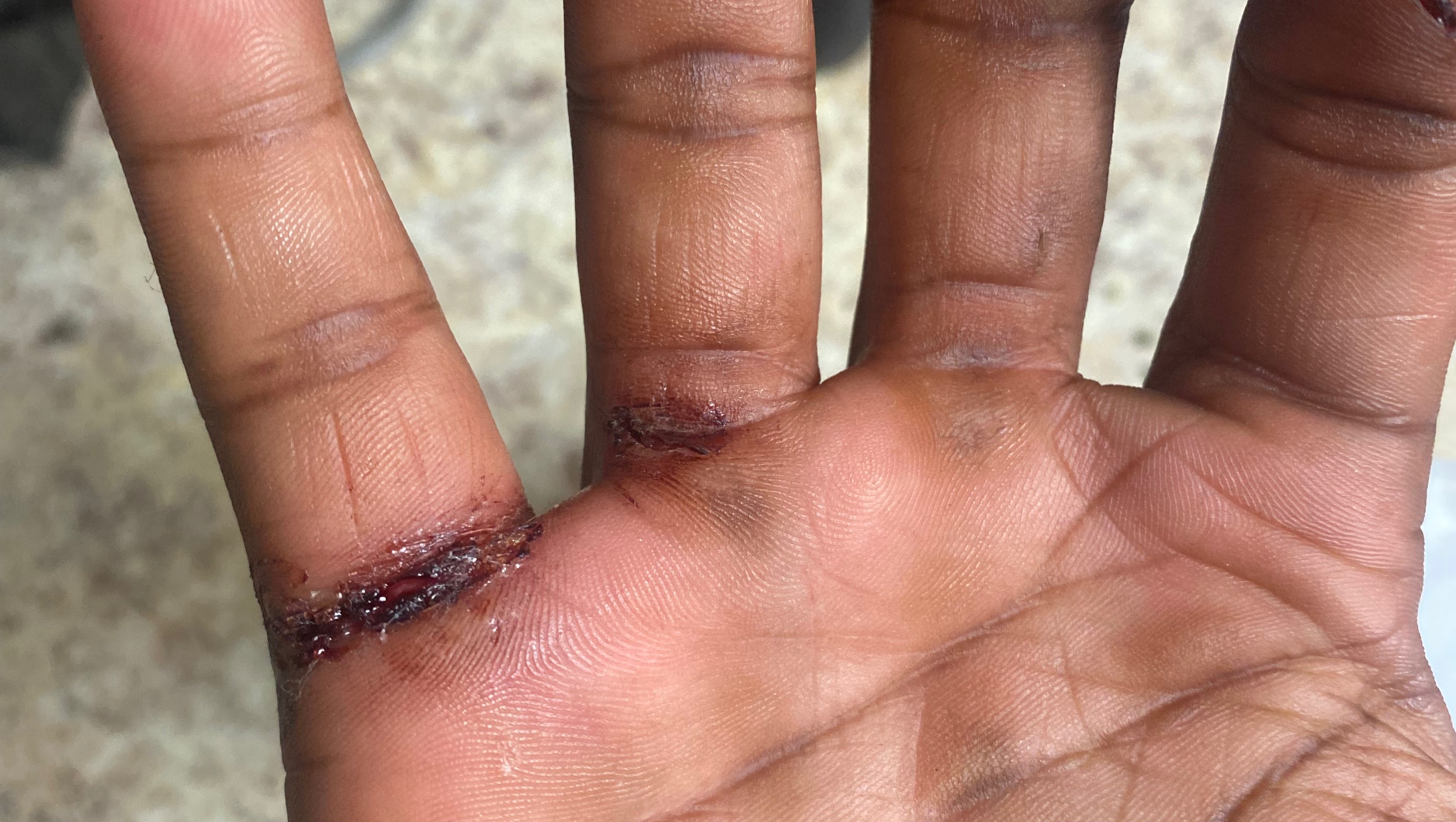 Help Malachi Recover and Support His Family photo