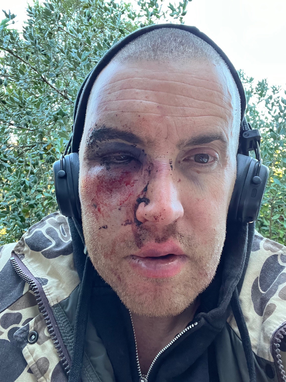 Fundraiser by Jake Luce : Support Jake's Recovery and Dental Care