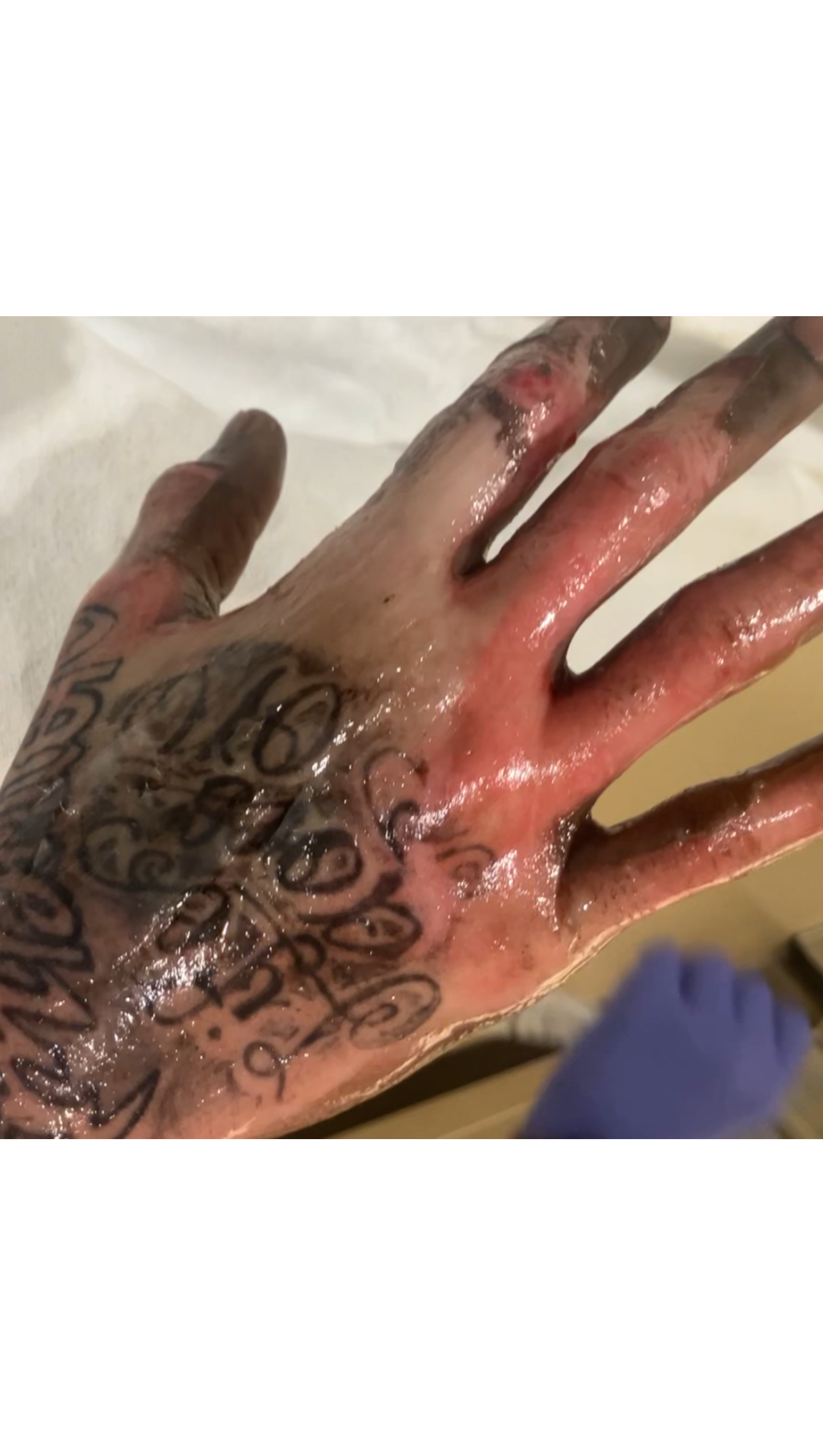 Support Savion’s Recovery & Family Care photo