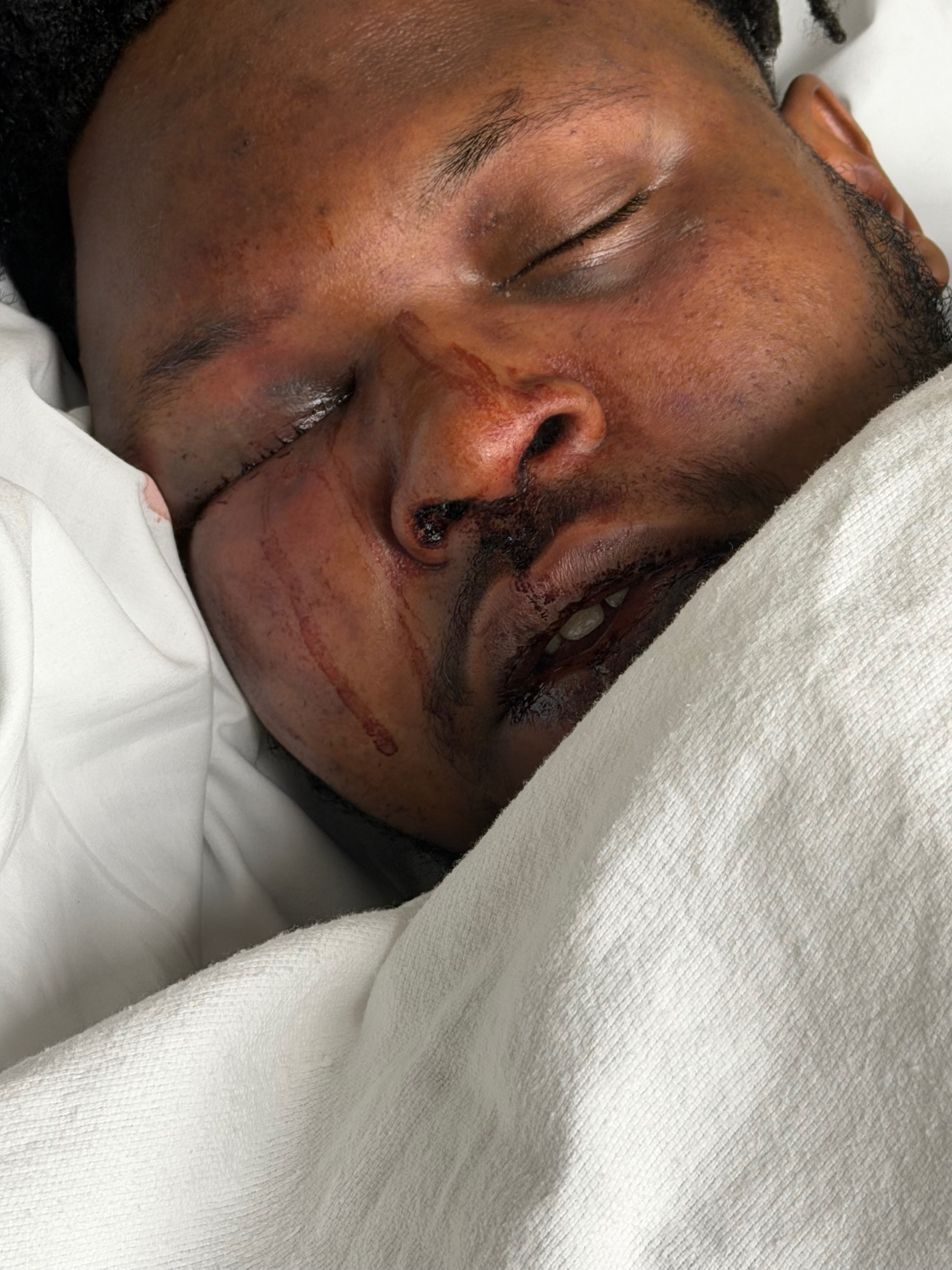 Justice and Healing for Malik After Hate Crime campaign photo, 4 of 5
