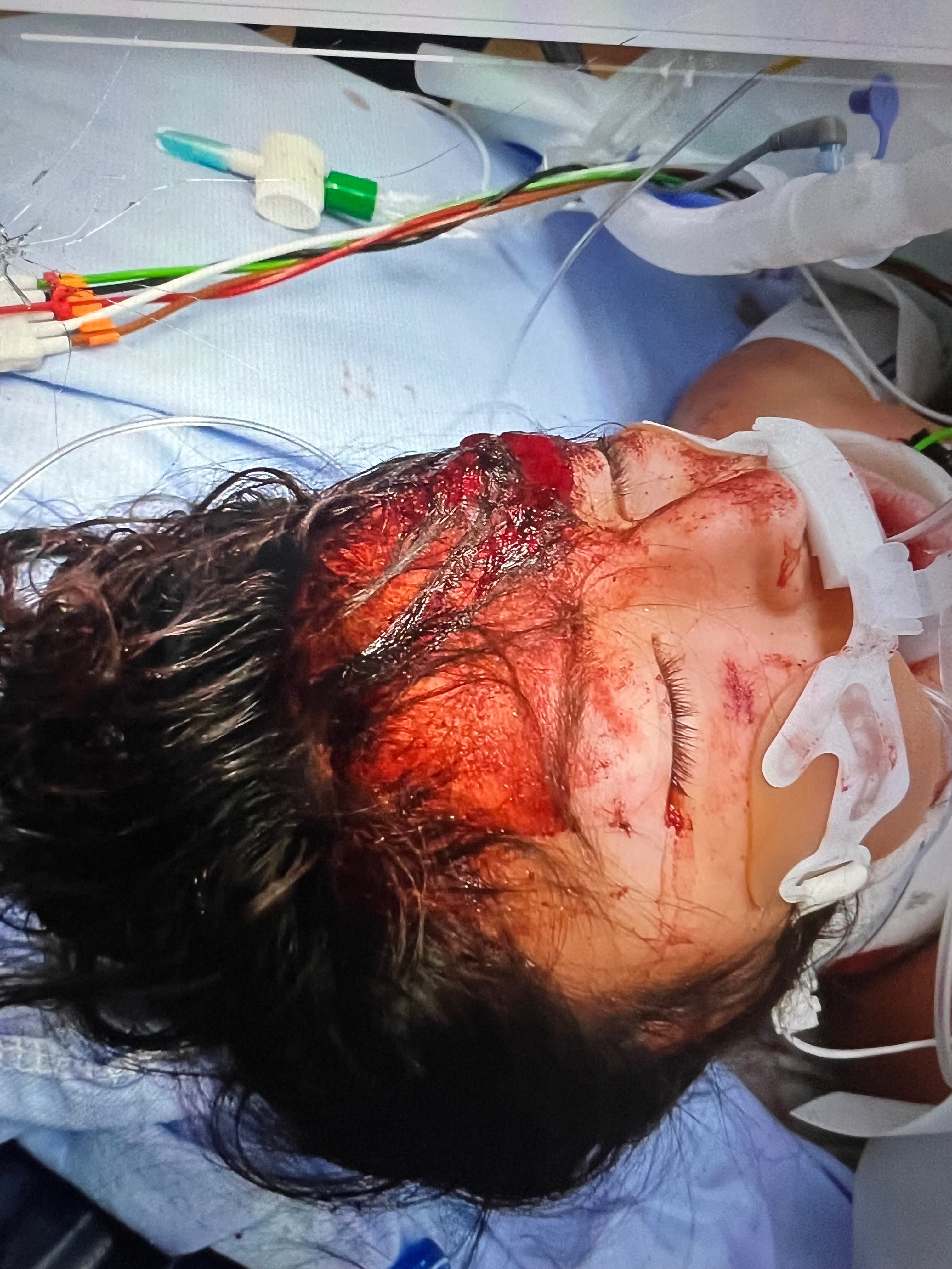 Ayuda a mis sobrinos victimas de un accidente campaign photo, 2 of 5