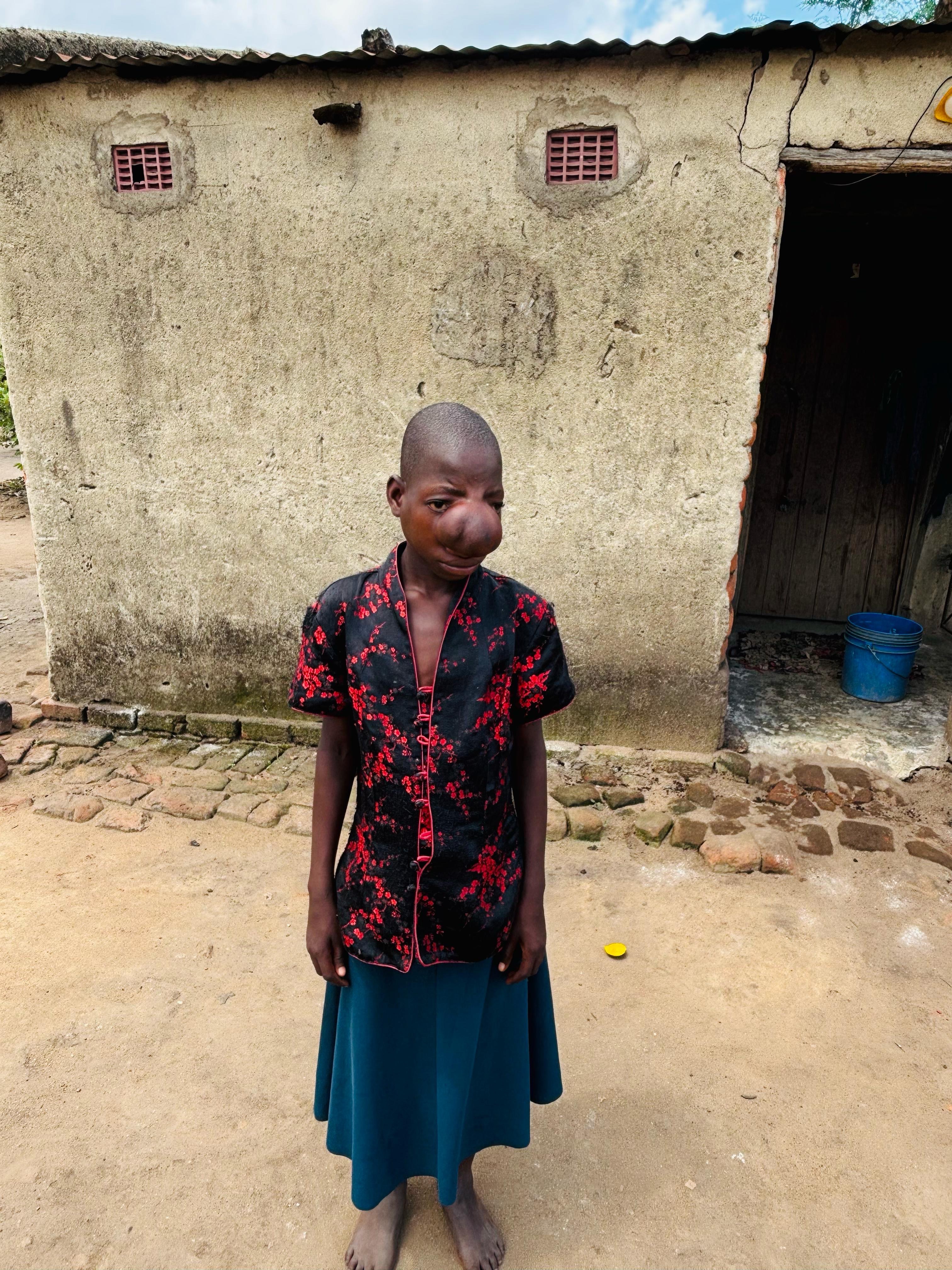 Help Yassa Get Life-Saving Surgery campaign photo, 5 of 6