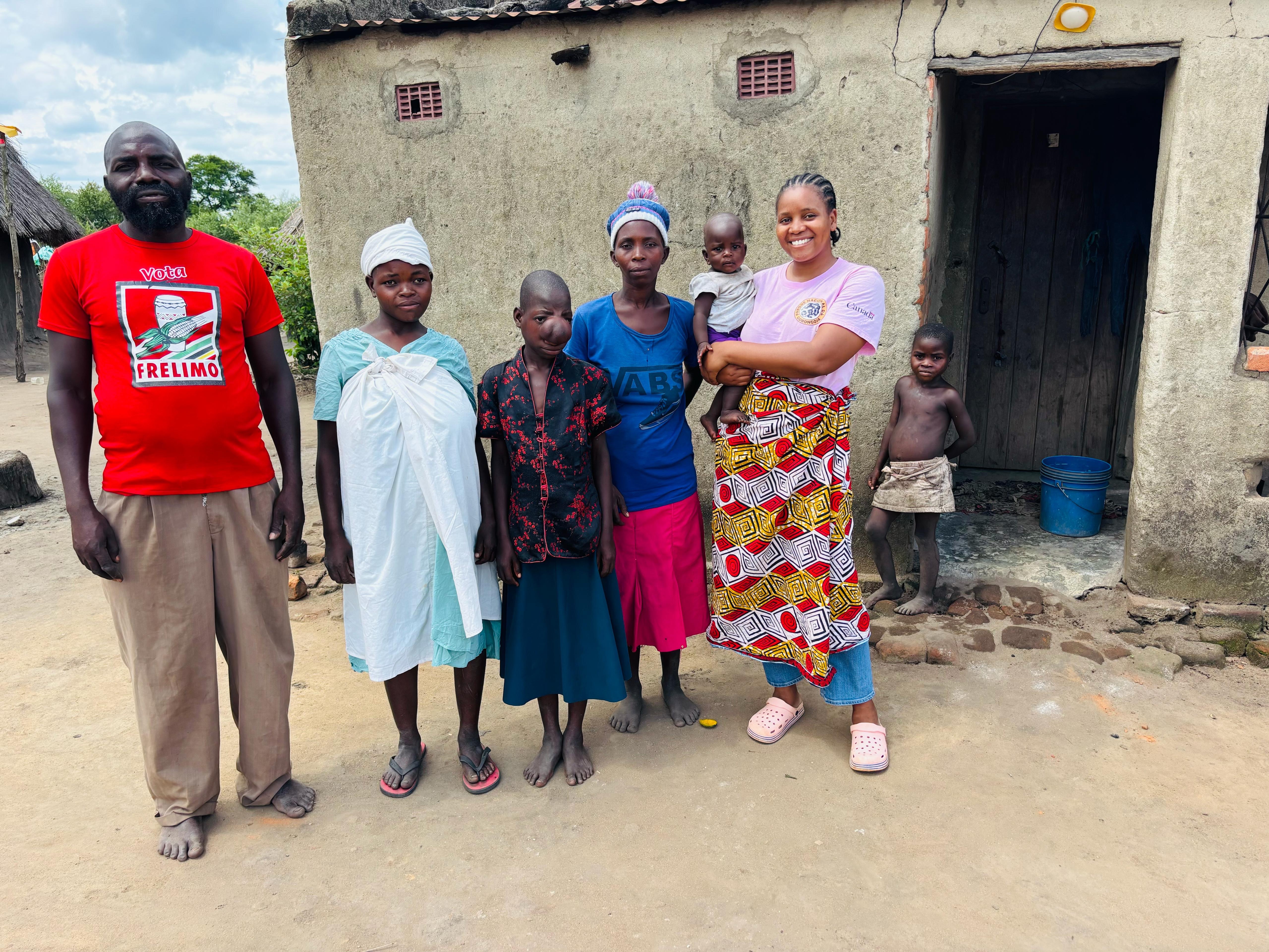 Help Yassa Get Life-Saving Surgery campaign photo, 4 of 6