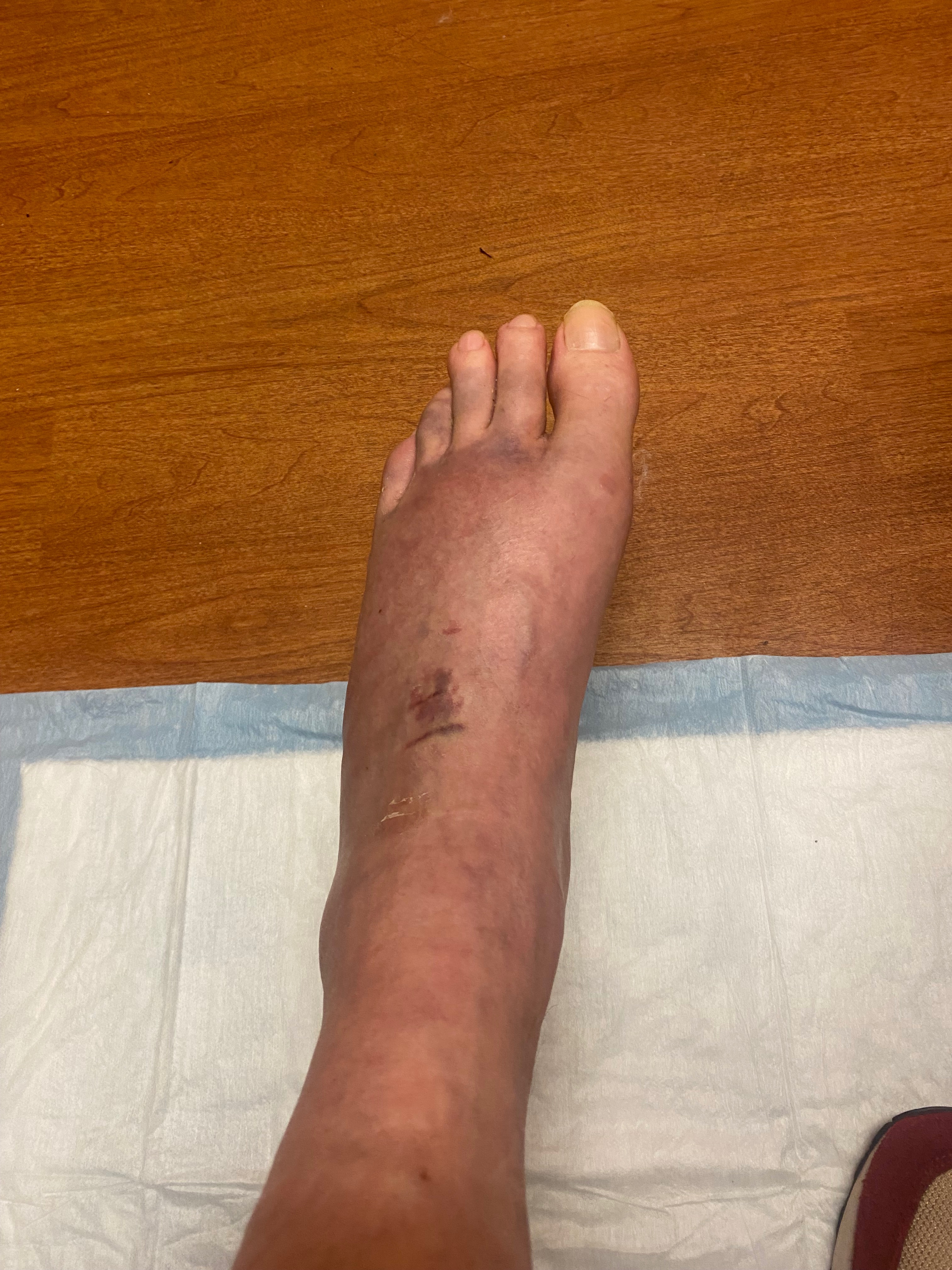 Support Elton’s Recovery After Injury campaign photo, 2 of 5