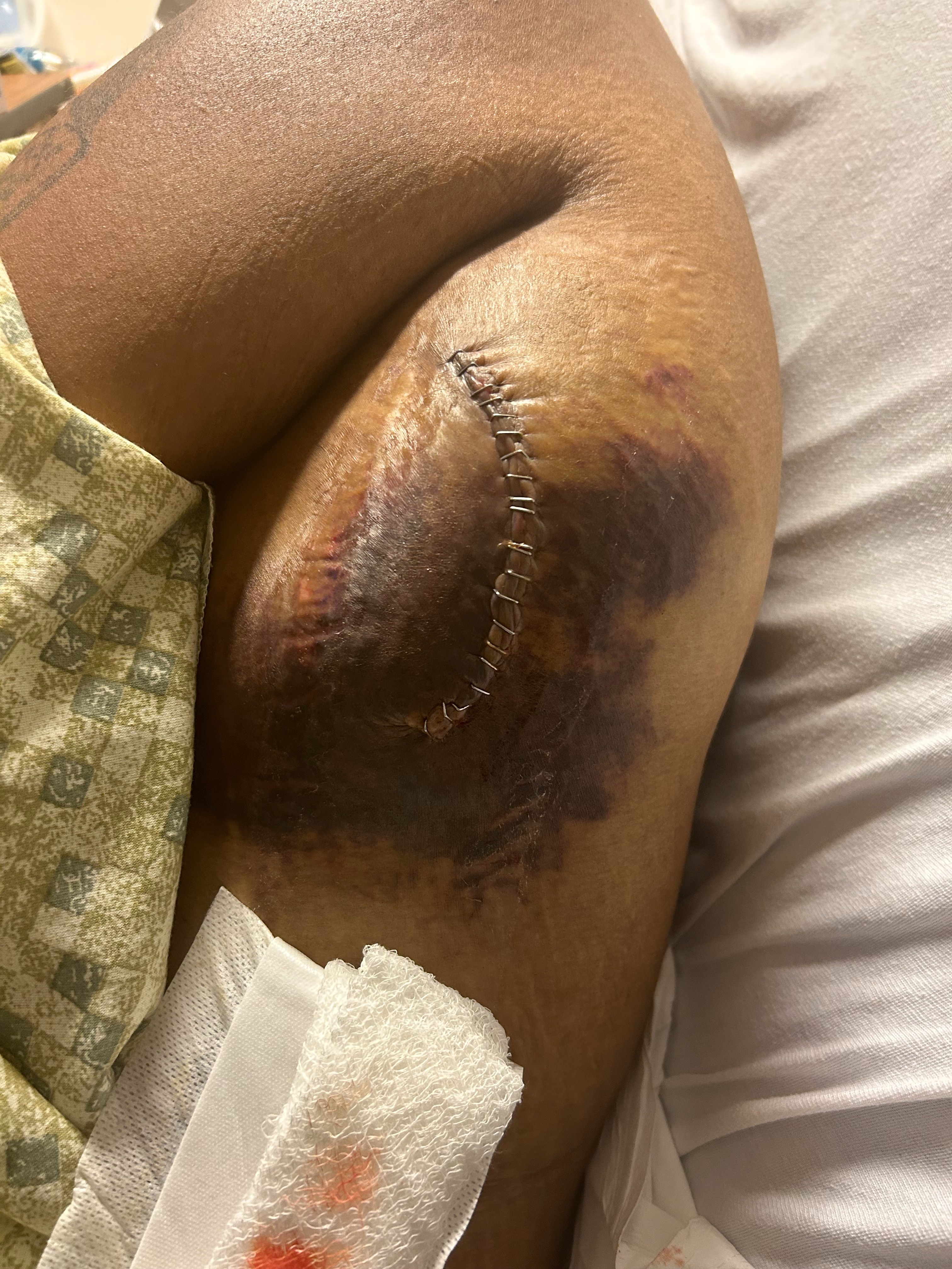 Help Octavius Travel for Vital Medical Care $Octo26-cash app campaign photo, 2 of 7