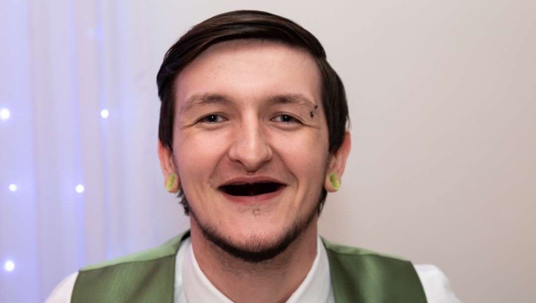 Support Trent’s Journey to a New Smile
