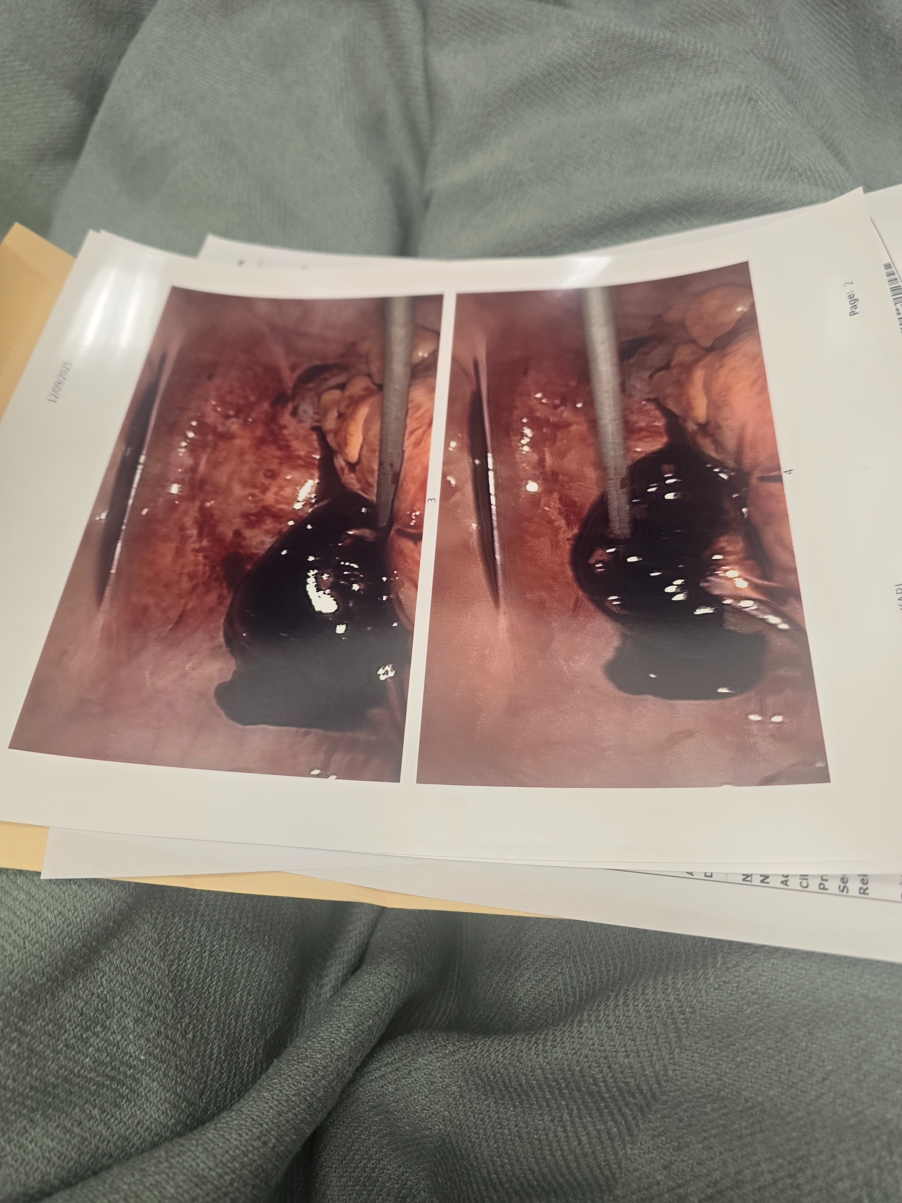 Support Kari & Sons after ER surgery campaign photo, 7 of 8