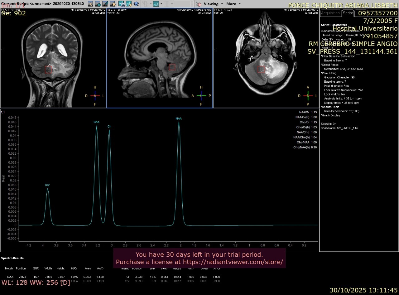 Cirugía urgente para Ariana , Tumor cerebral -Fosa Posterior campaign photo, 7 of 8