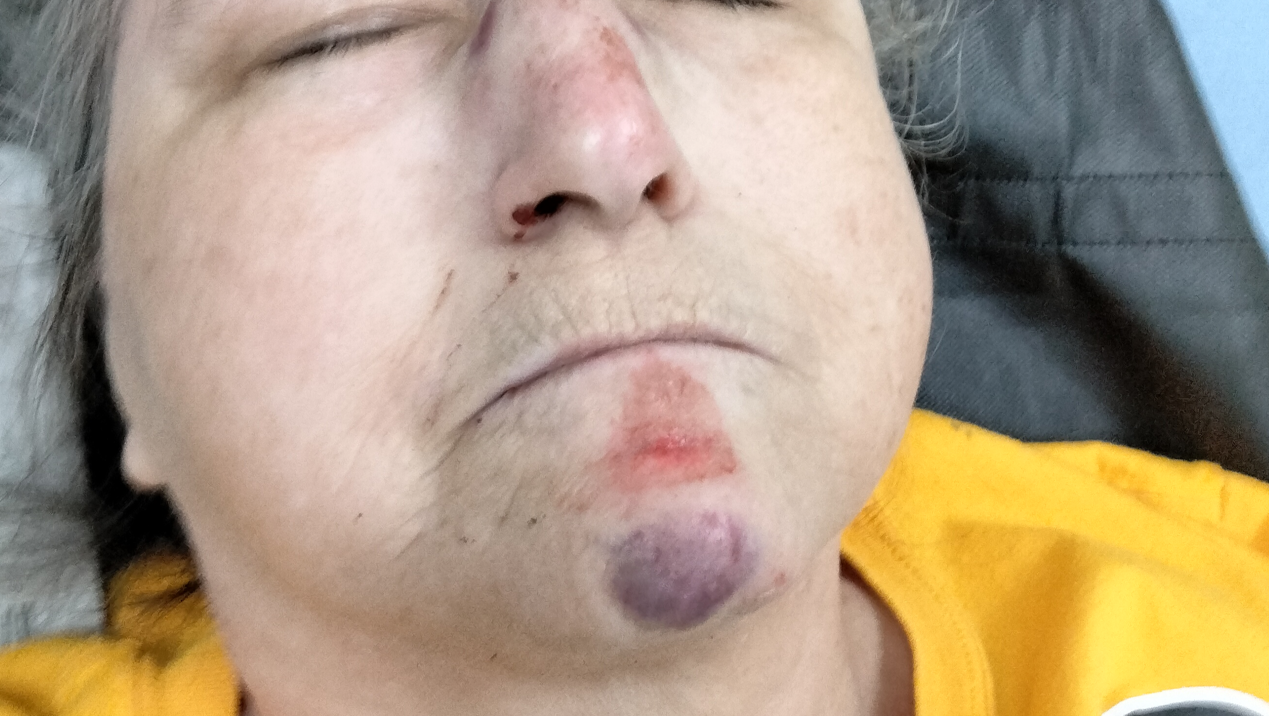 Support My Wife’s Recovery After Her Fall photo