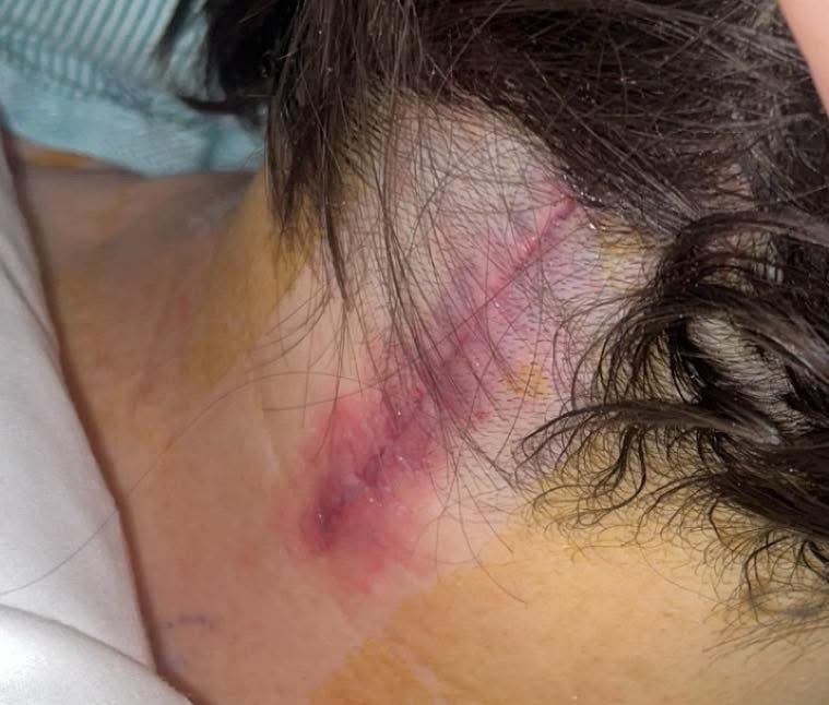 Support Rachel McKinney's Healing Journey campaign photo, 4 of 5