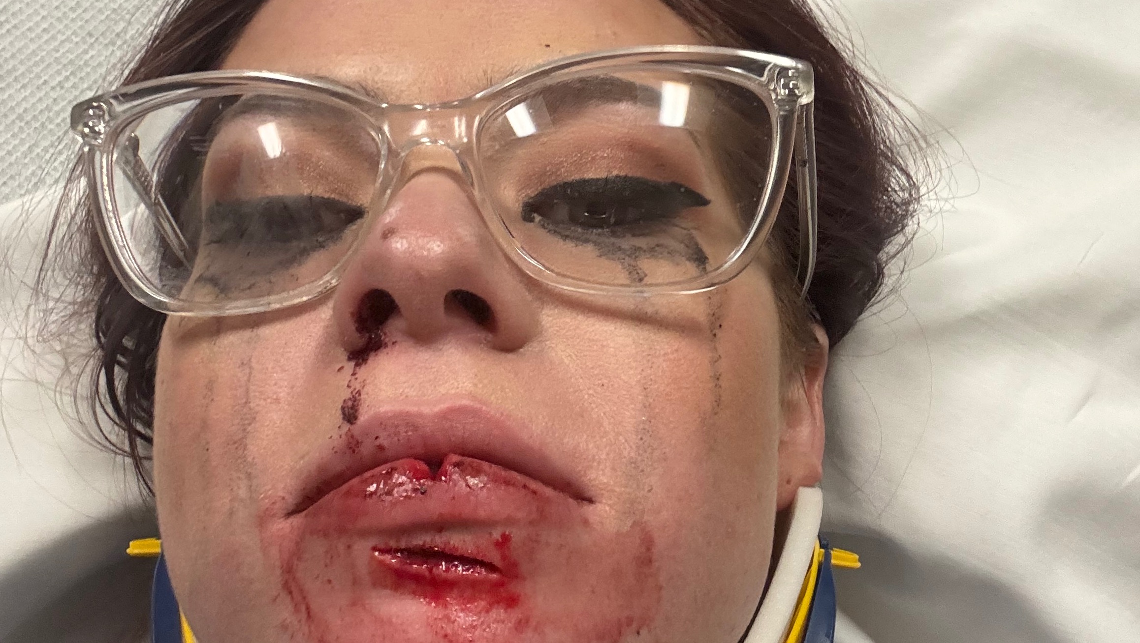 Support My Recovery After a Serious Car Accident pinned link photo