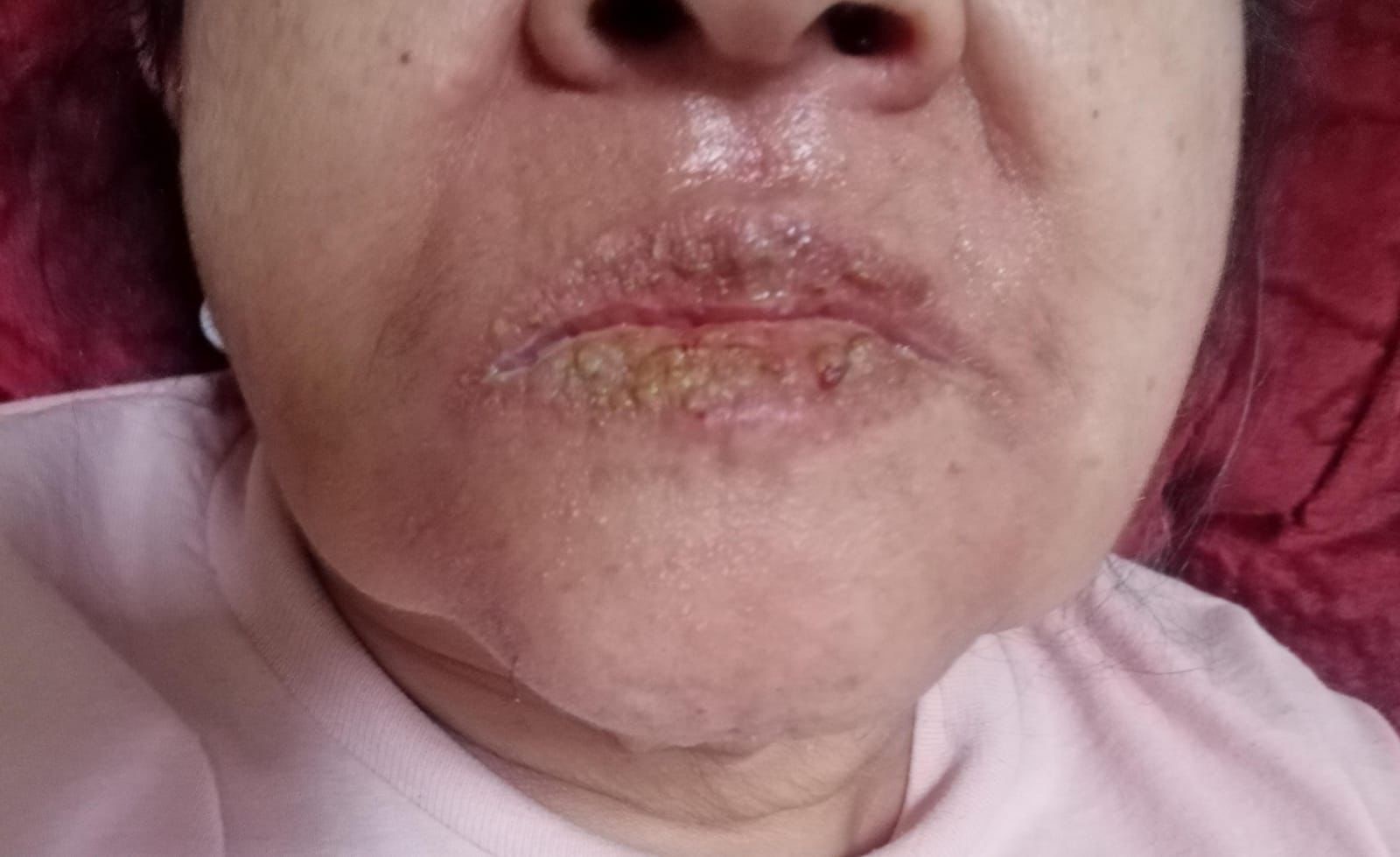 Help My Aunt Recover from Emergency Surgery campaign photo, 4 of 7