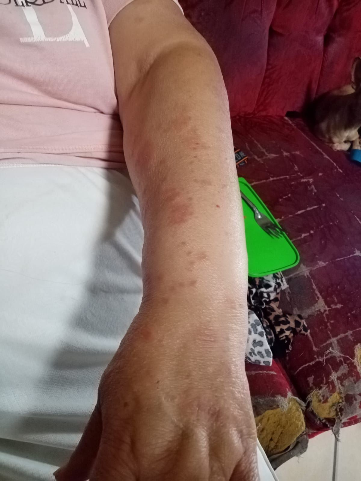Help My Aunt Recover from Emergency Surgery campaign photo, 5 of 7