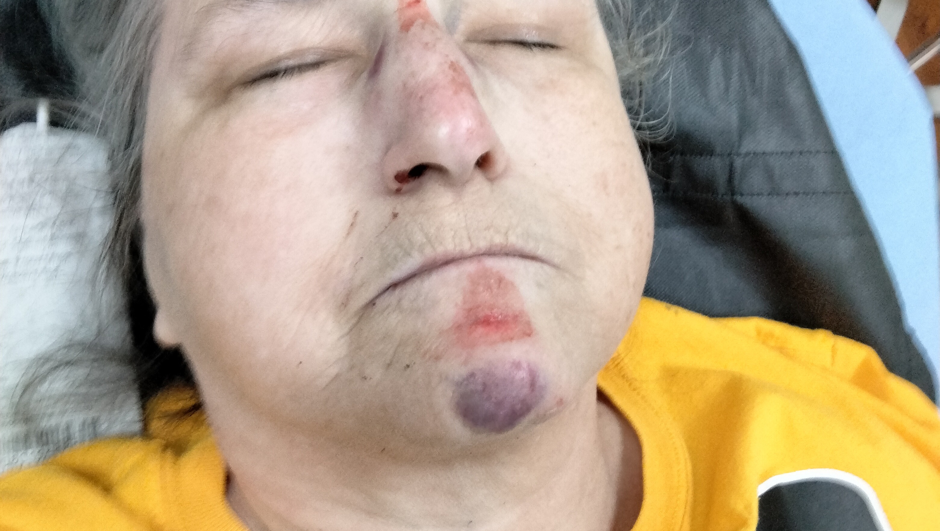 Support for My Wife’s Recovery photo
