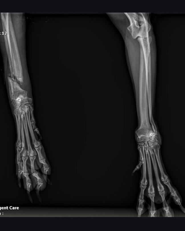 "Please don't let them take my leg" campaign photo, 6 of 8
