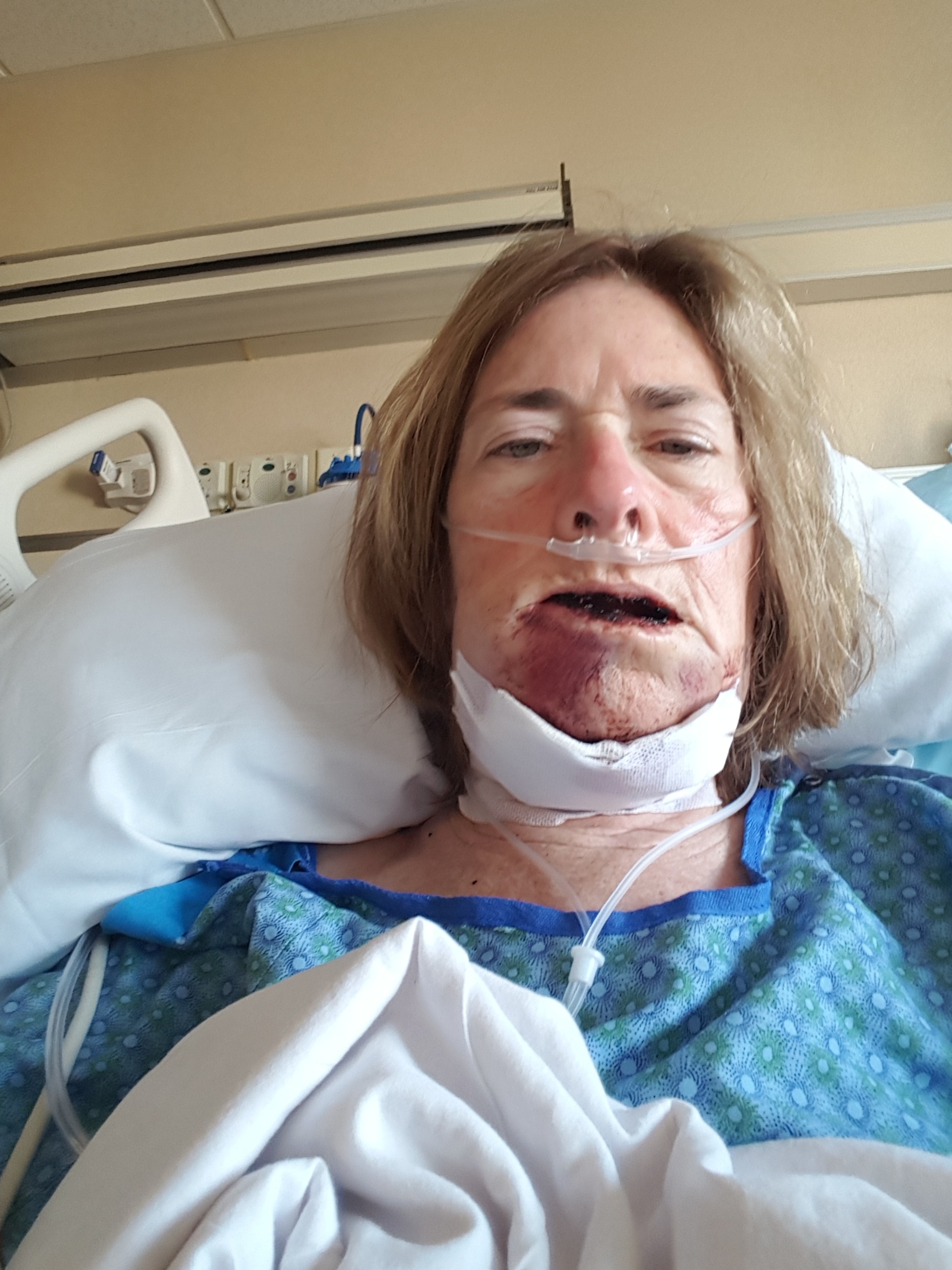Support Mary’s Journey to Healing and Recovery campaign photo, 2 of 4