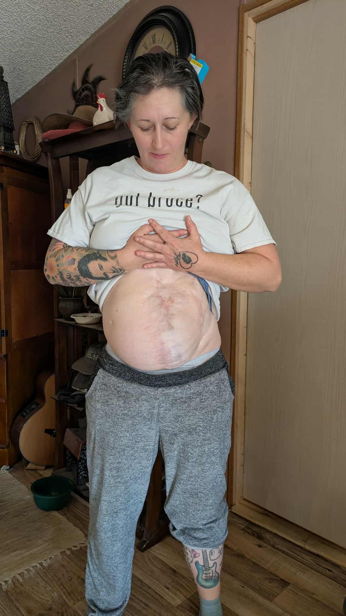 Help Krystal Recover After Life-Changing Surgery campaign photo, 2 of 7