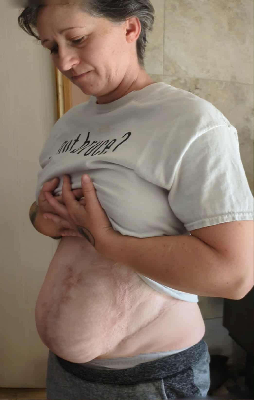 Help Krystal Recover After Life-Changing Surgery campaign photo, 6 of 7