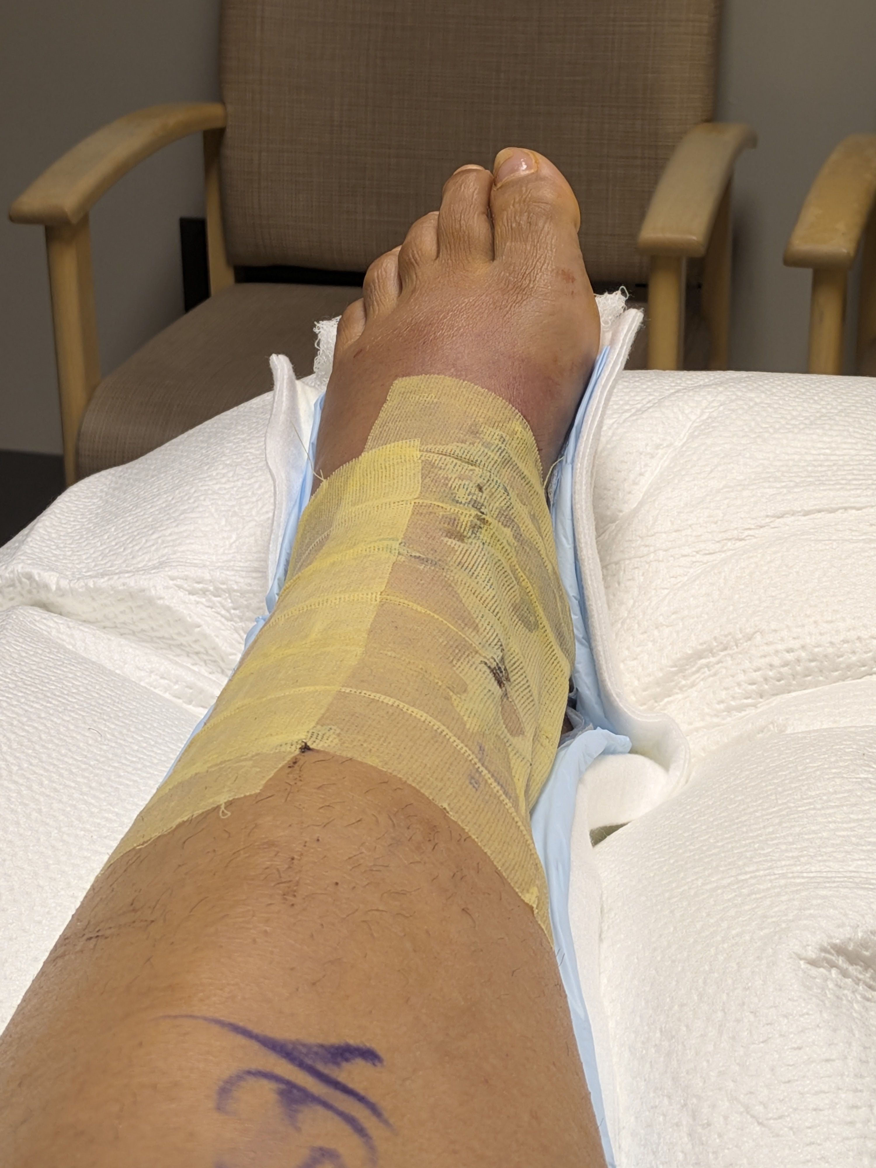 Aid My Journey to Walk Again After the Accident campaign photo, 2 of 6