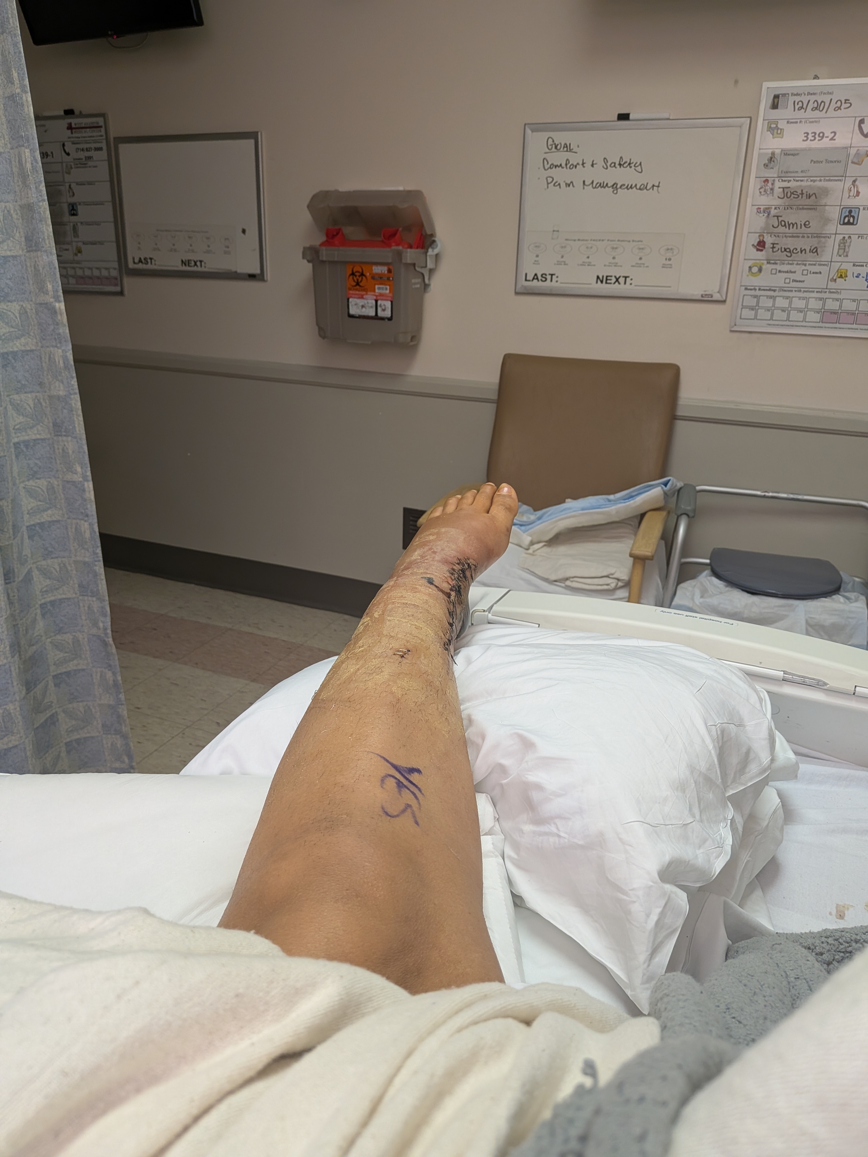 Aid My Journey to Walk Again After the Accident campaign photo, 4 of 6