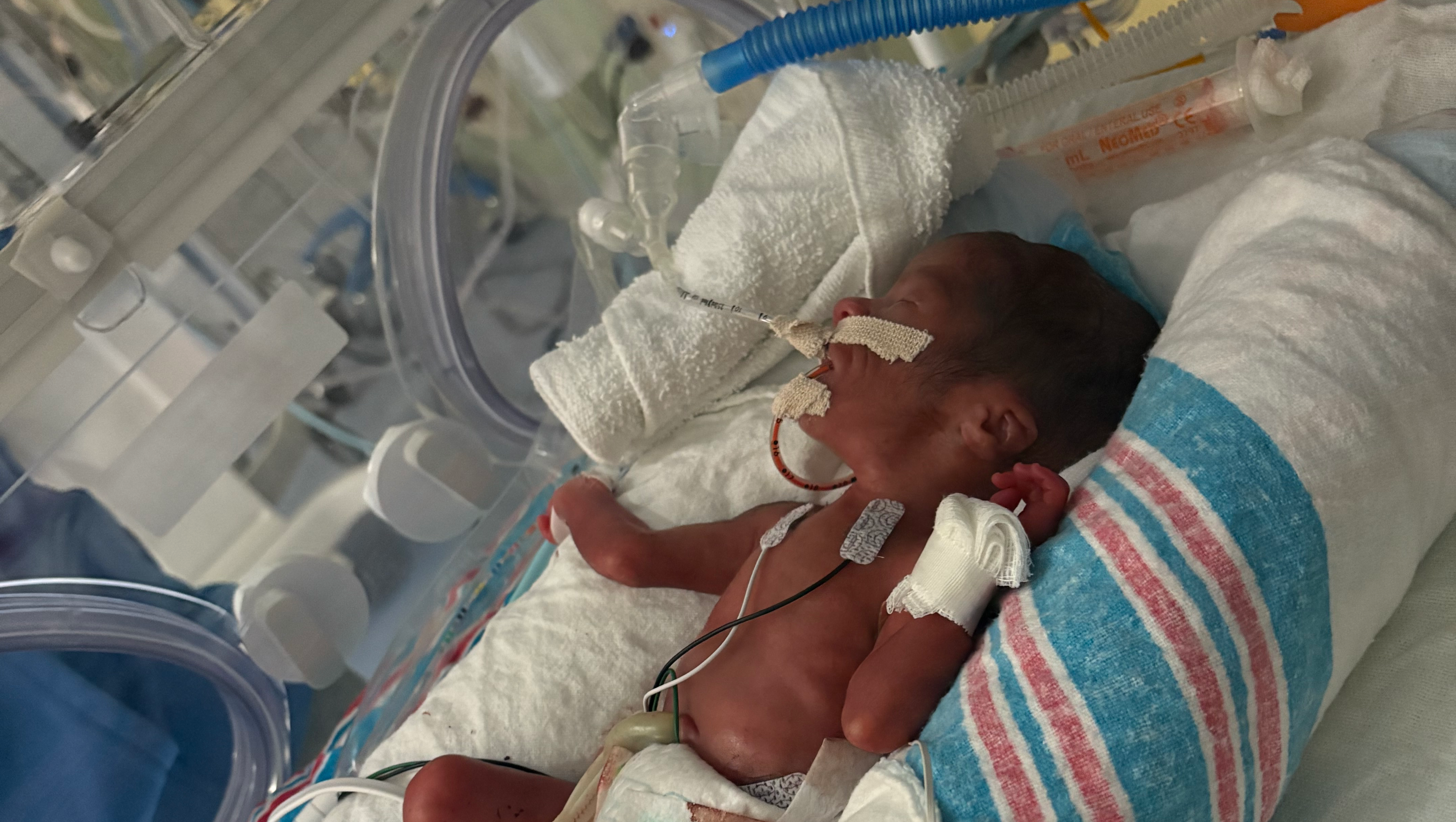 Miracle 25-Week Preemie 107-Day NICU Journey • Family Relief photo