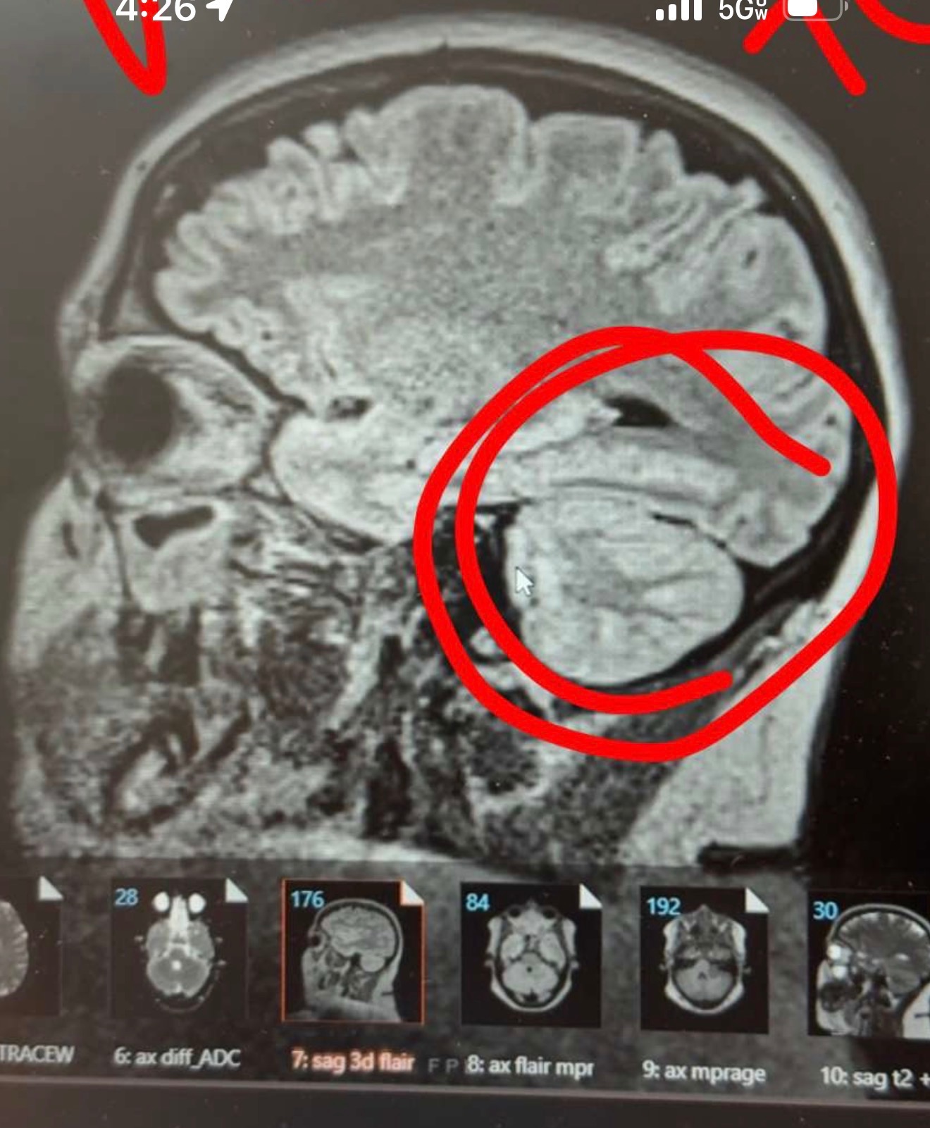 Prayers and Support for Annie’s Brain Surgery campaign photo, 4 of 5