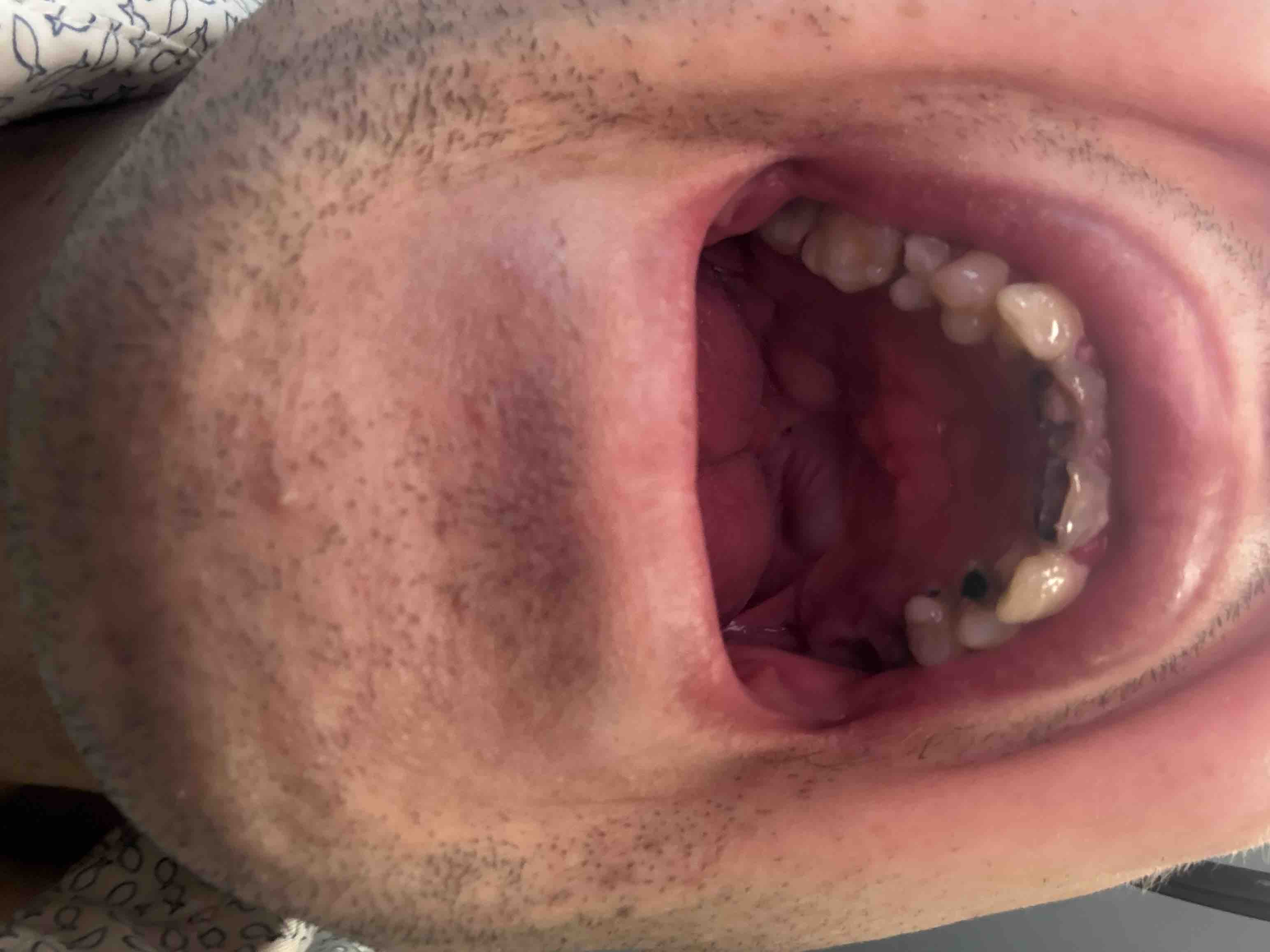 Support Ben’s Journey to a Confident Smile campaign photo, 5 of 10