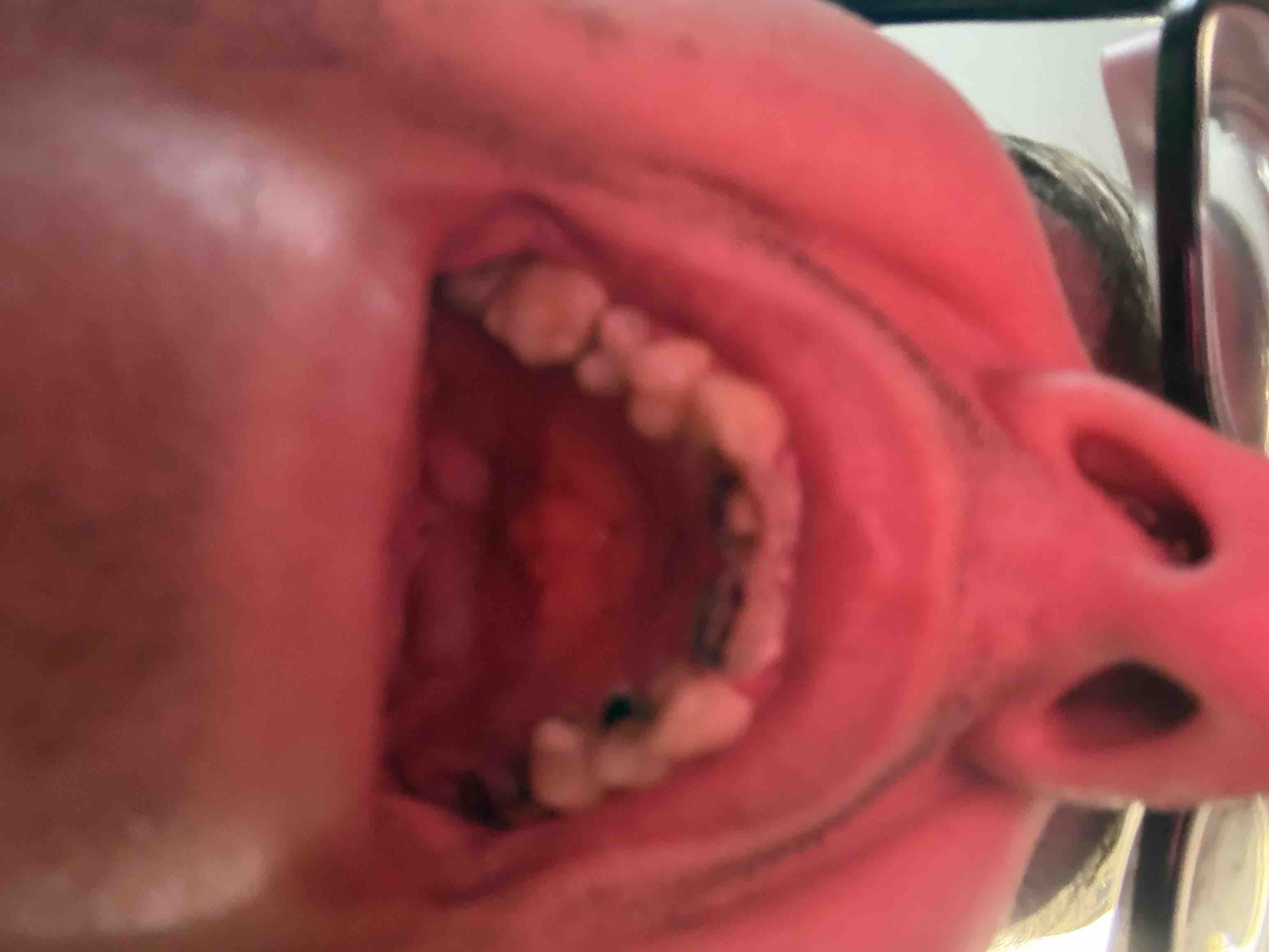 Support Ben’s Journey to a Confident Smile campaign photo, 6 of 10