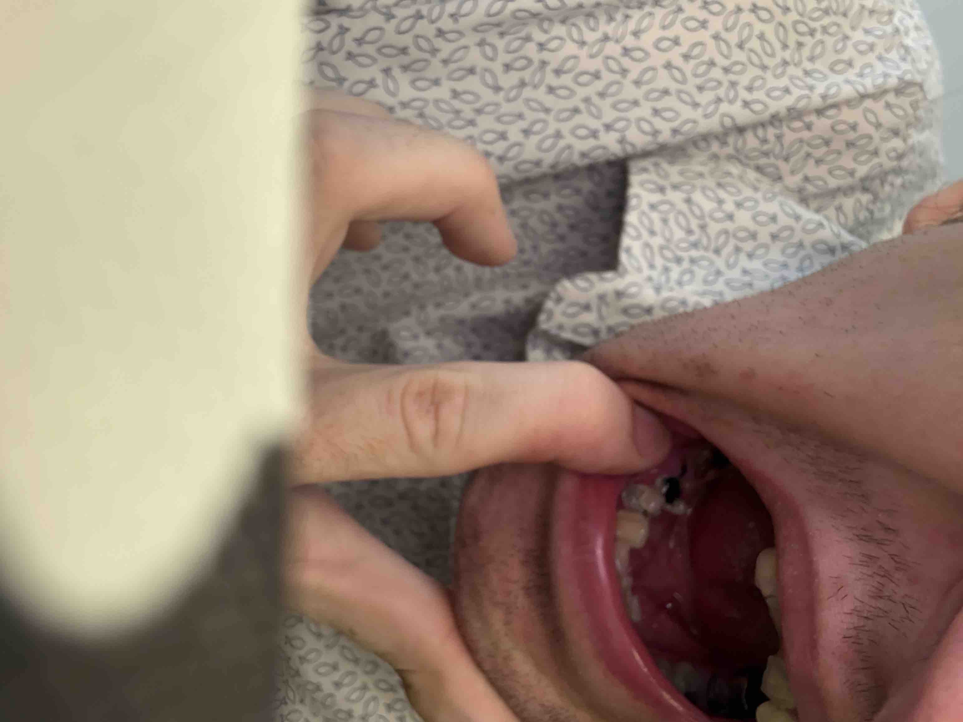 Support Ben’s Journey to a Confident Smile campaign photo, 7 of 10