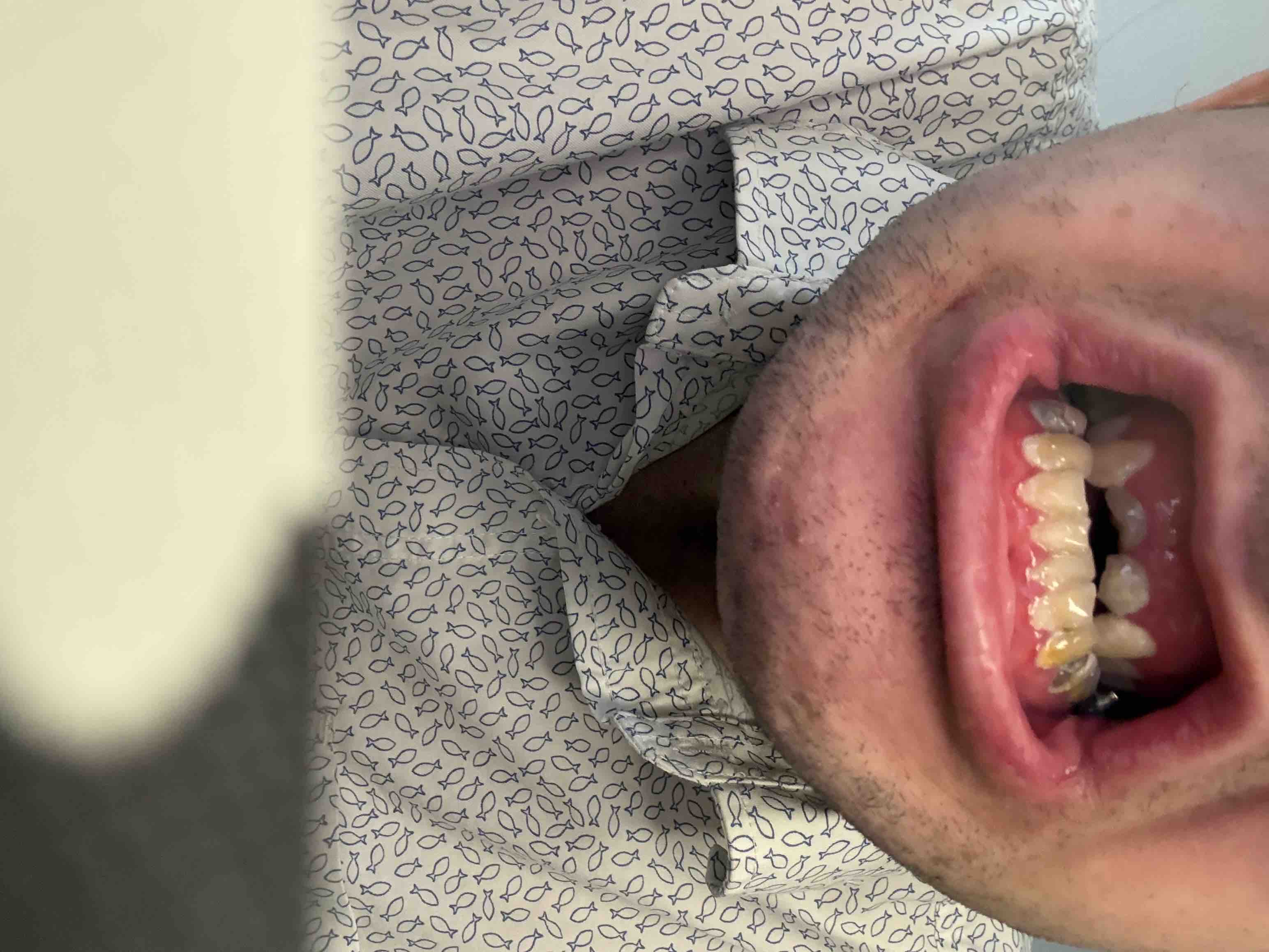 Support Ben’s Journey to a Confident Smile campaign photo, 8 of 10