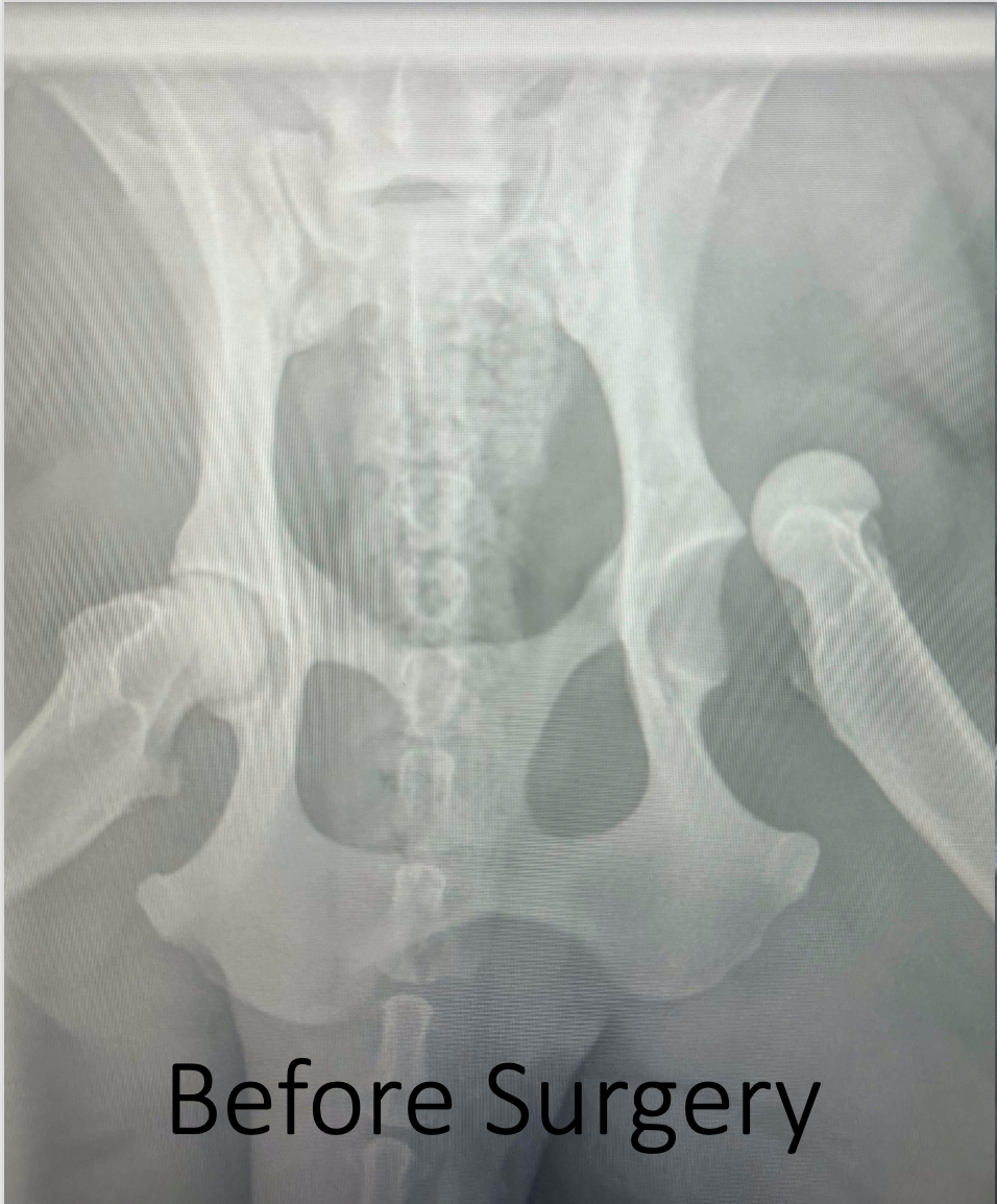 Lexie's Emergency Hip Surgery Fund - Anything Helps ❤️ campaign photo, 2 of 7