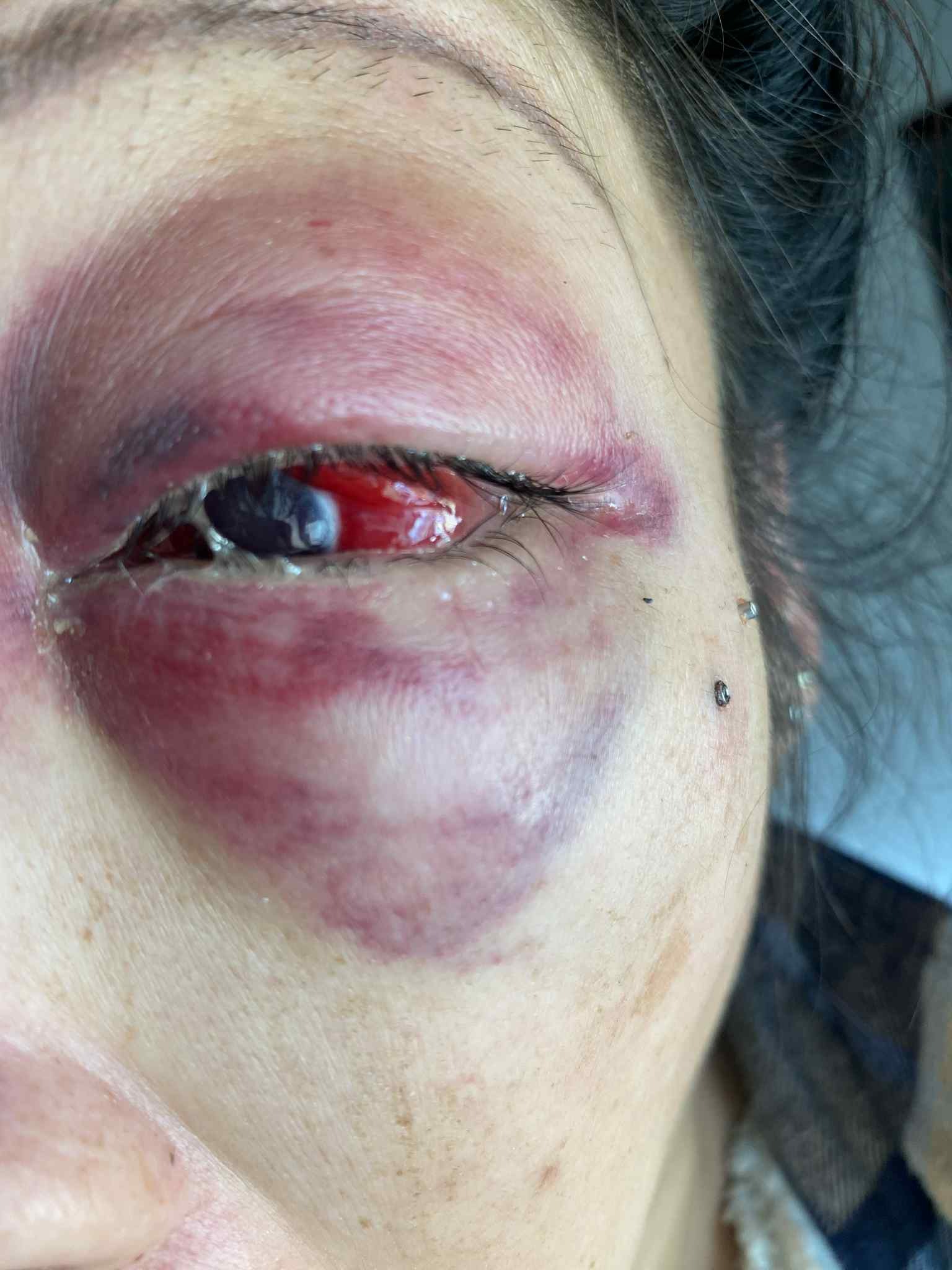 Support Mayleen’s Recovery campaign photo, 5 of 6