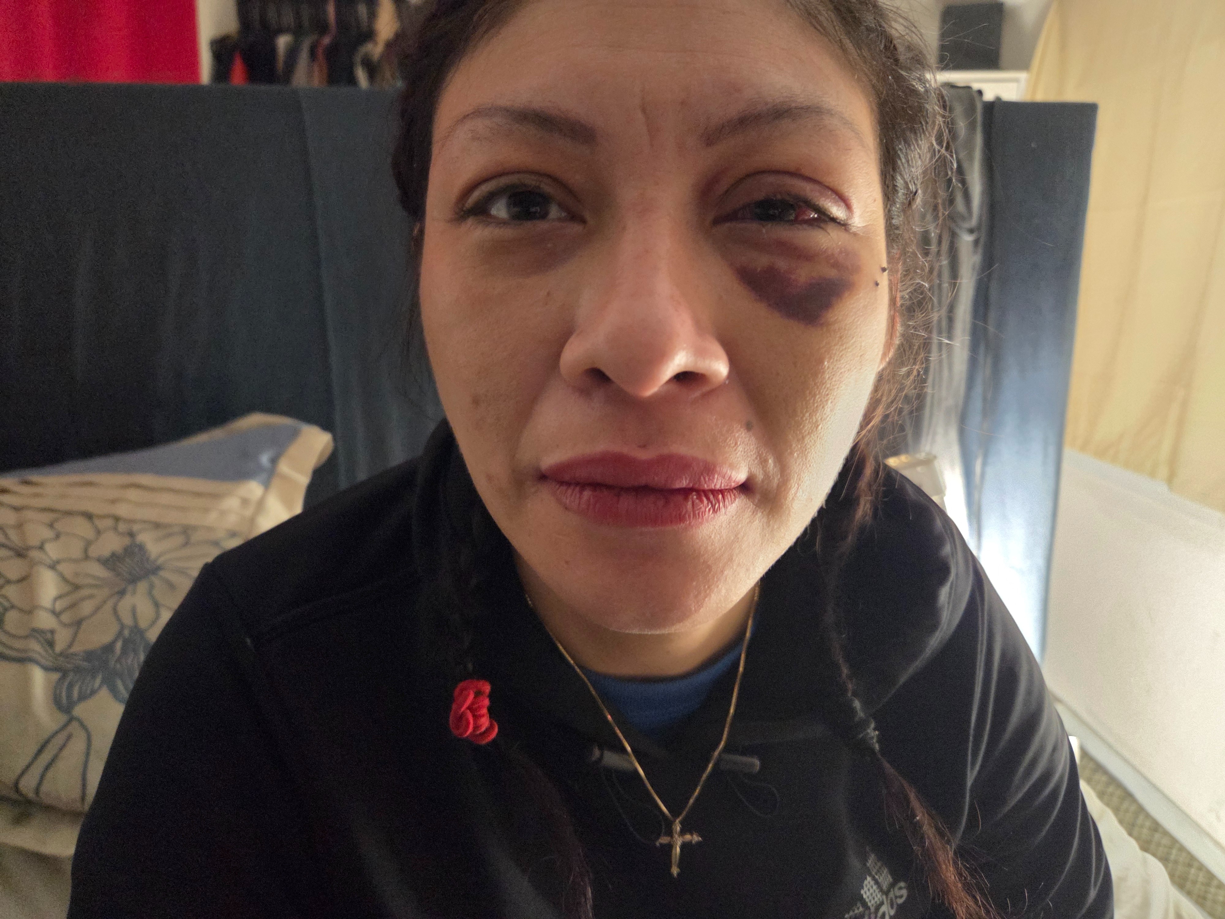 Support Mayleen’s Recovery campaign photo, 4 of 6