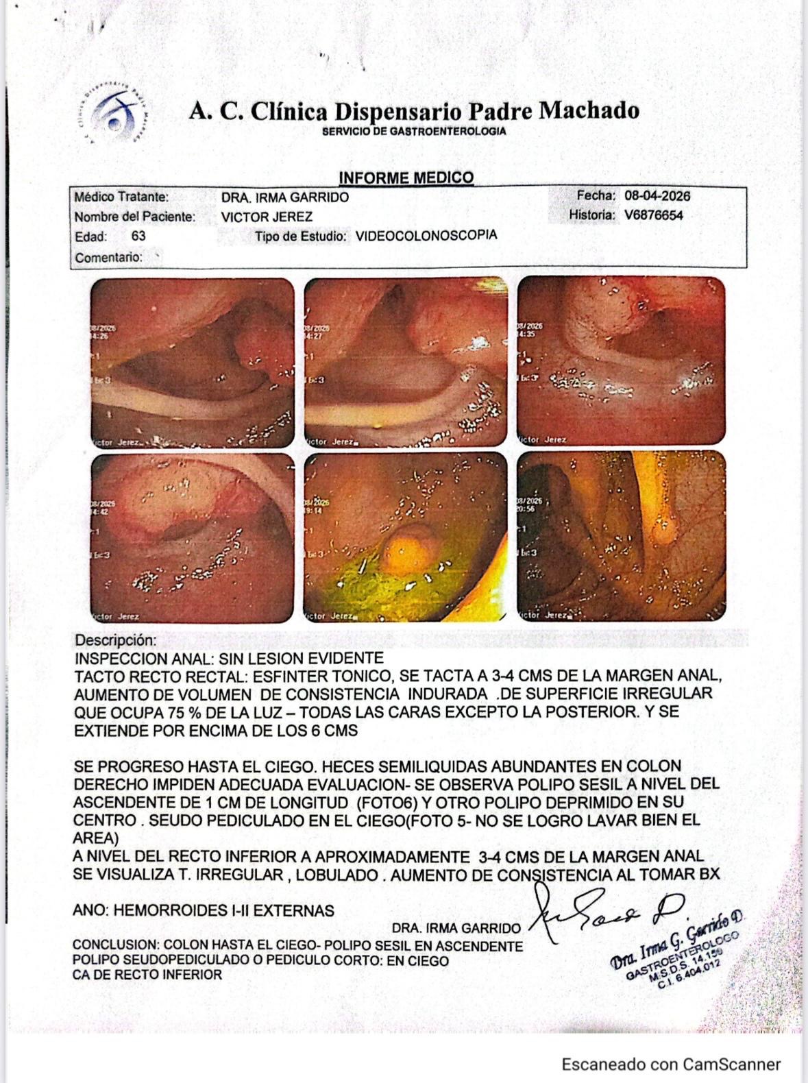Ayudemos a Victor Jerez con su lucha contra el Cancer  campaign photo, 2 of 6