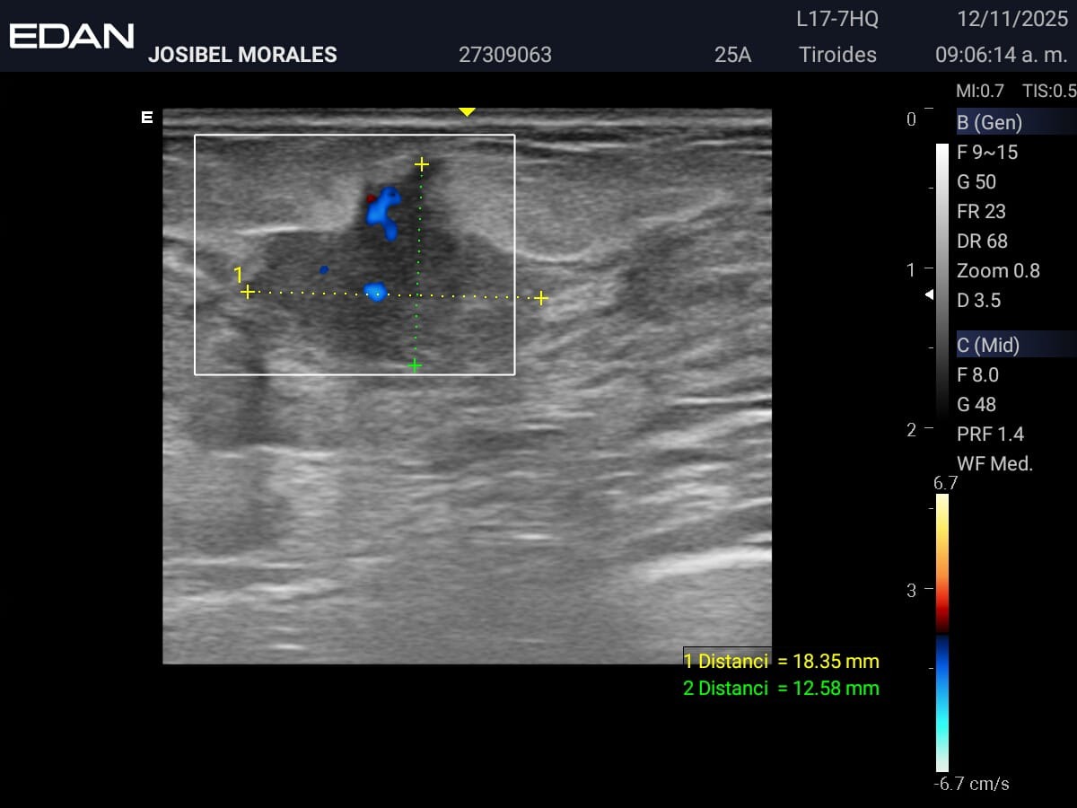 Support Josybel’s Urgent Breast Cancer Treatment campaign photo, 4 of 8
