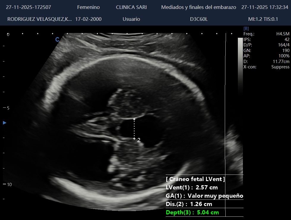 Un pequeño guerrero necesita de nuestra ayuda con urgencia campaign photo, 4 of 5