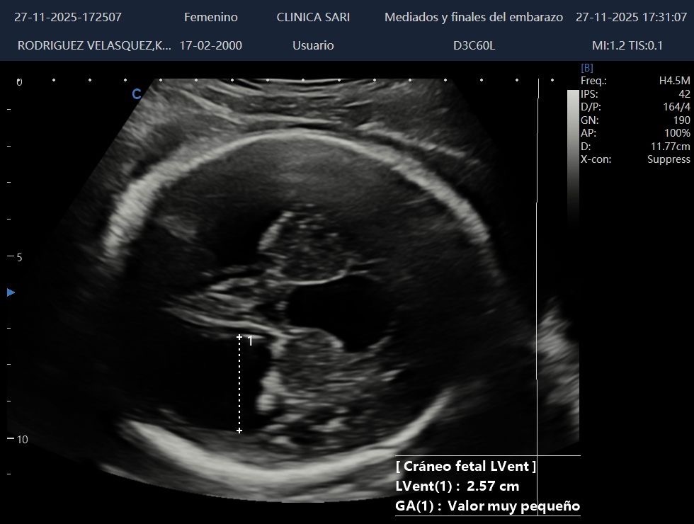 Un pequeño guerrero necesita de nuestra ayuda con urgencia campaign photo, 2 of 5