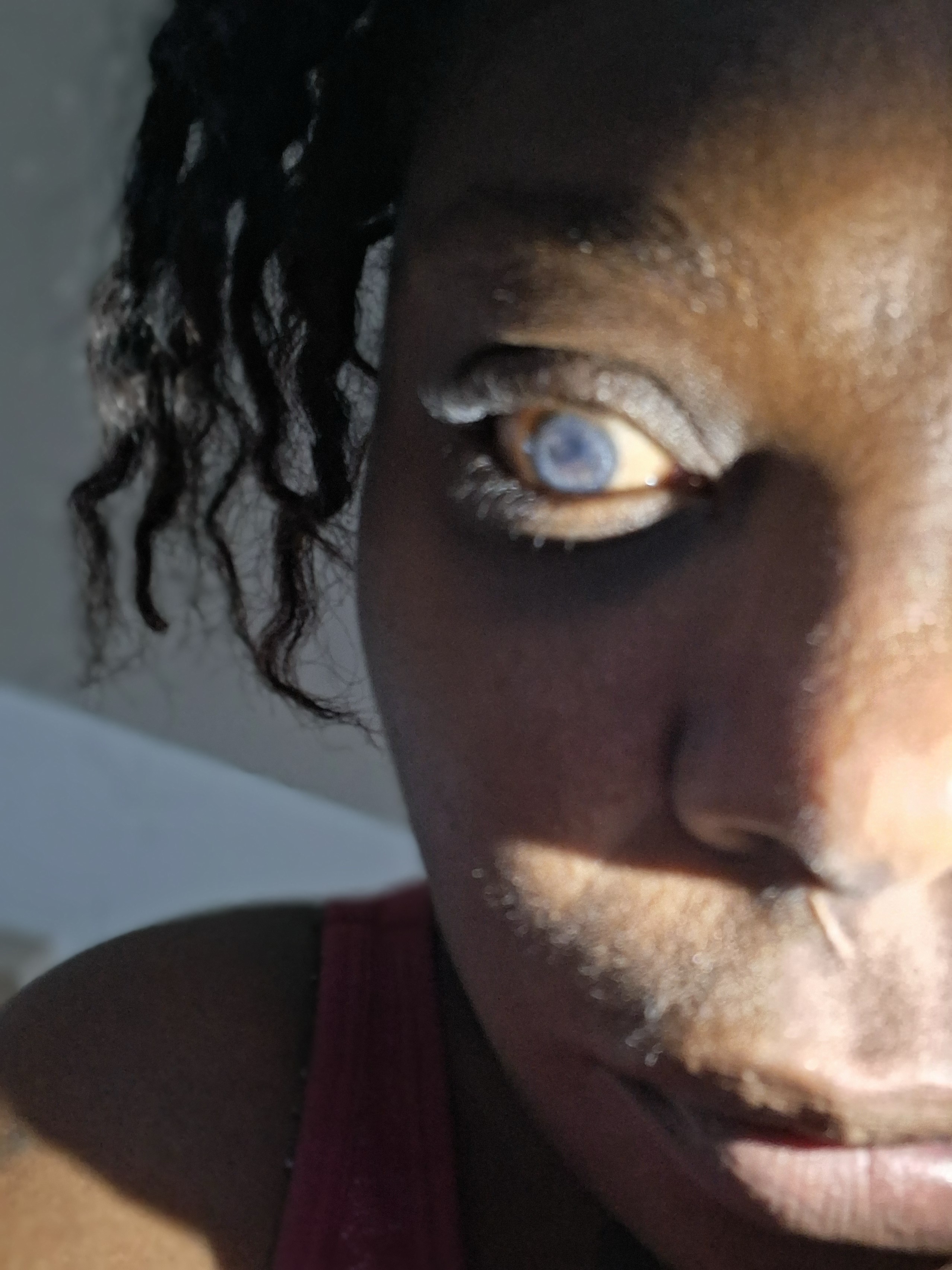 Help Patricia Get Her Prosthetic Eye campaign photo, 2 of 6