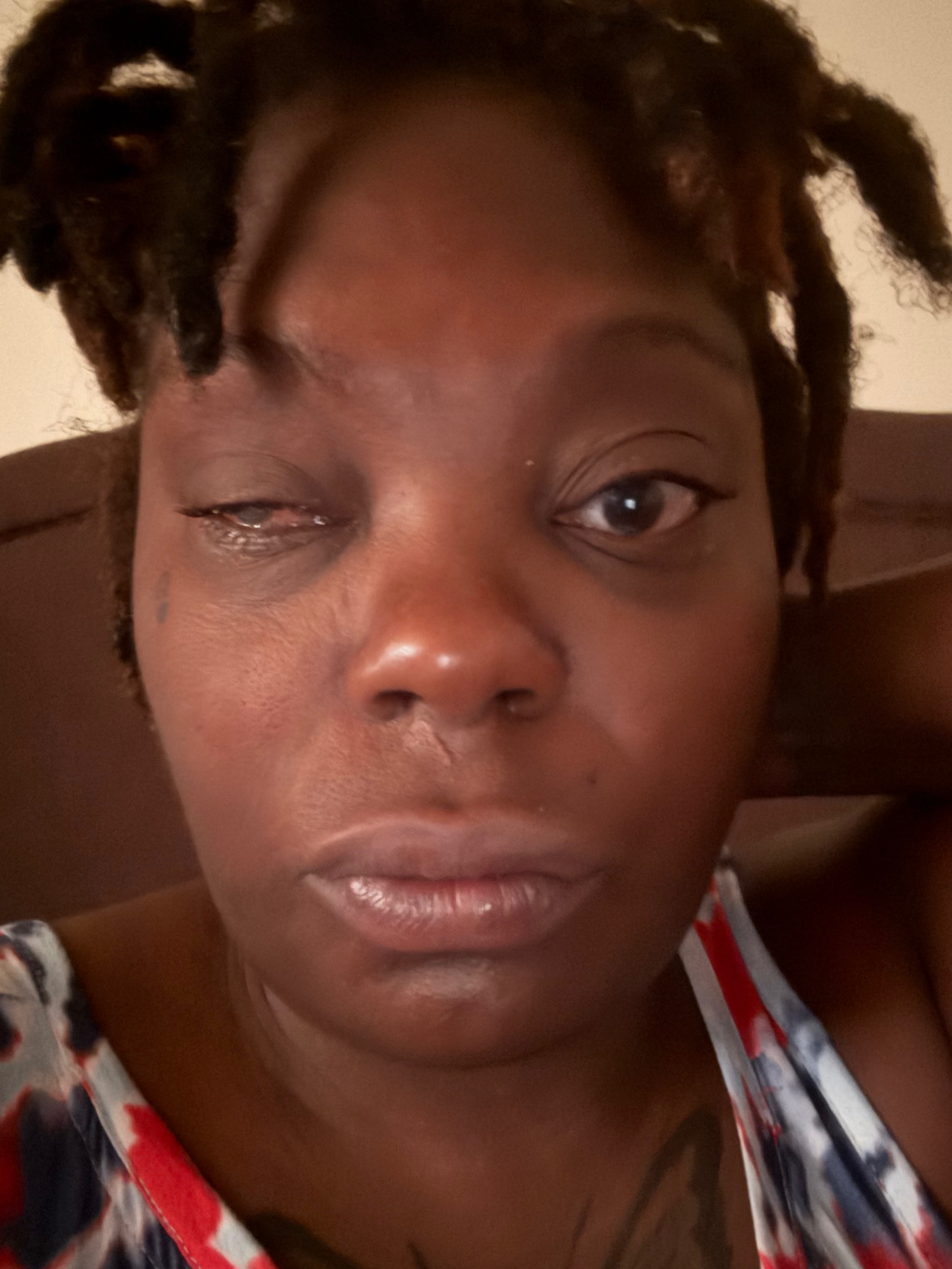 Help Patricia Get Her Prosthetic Eye campaign photo, 4 of 6