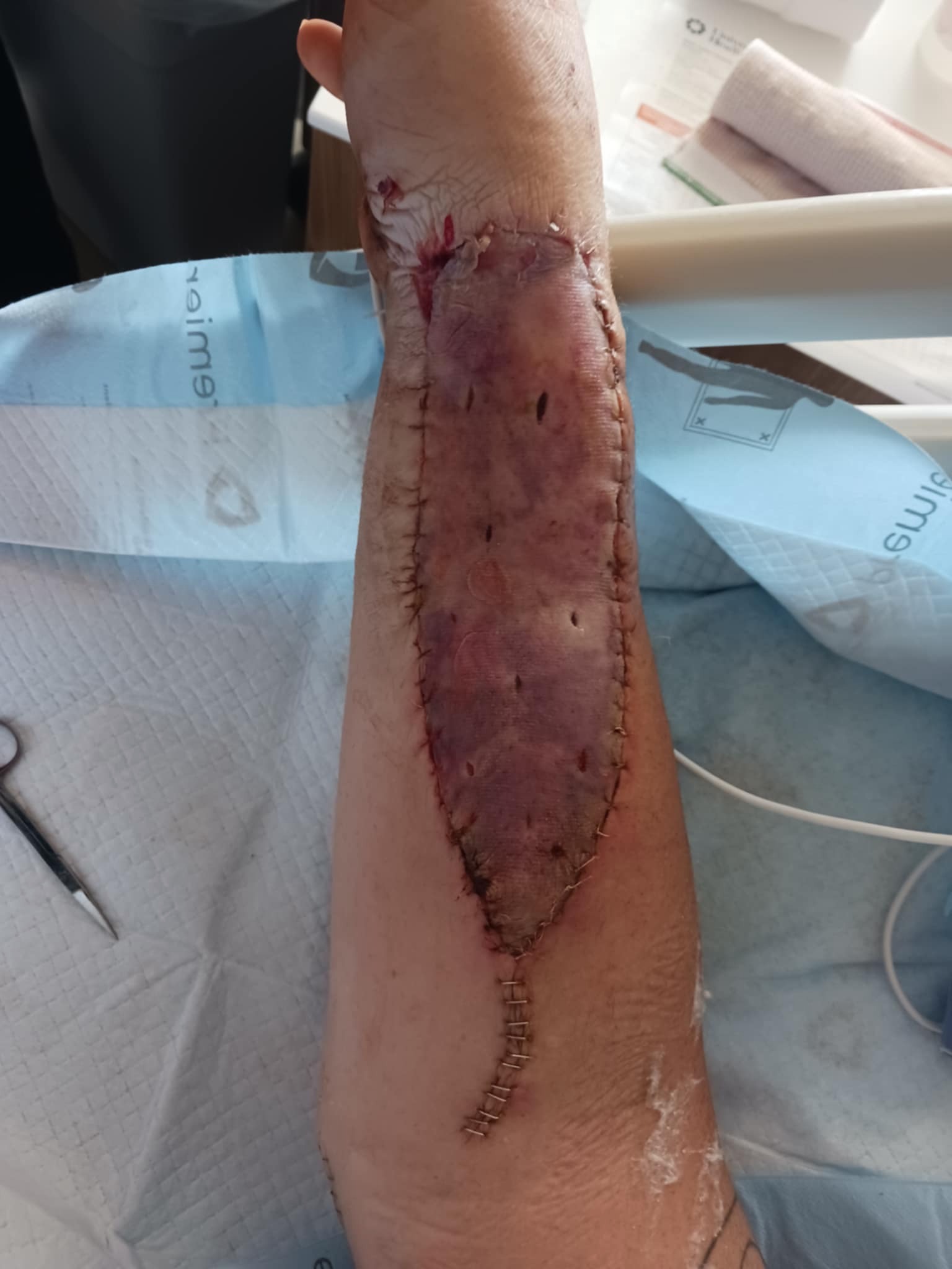 Help David Walk Again After Tragic Accident campaign photo, 5 of 6