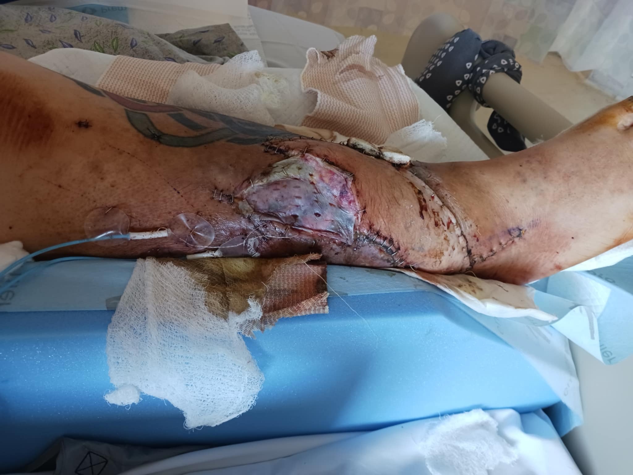 Help David Walk Again After Tragic Accident campaign photo, 2 of 6