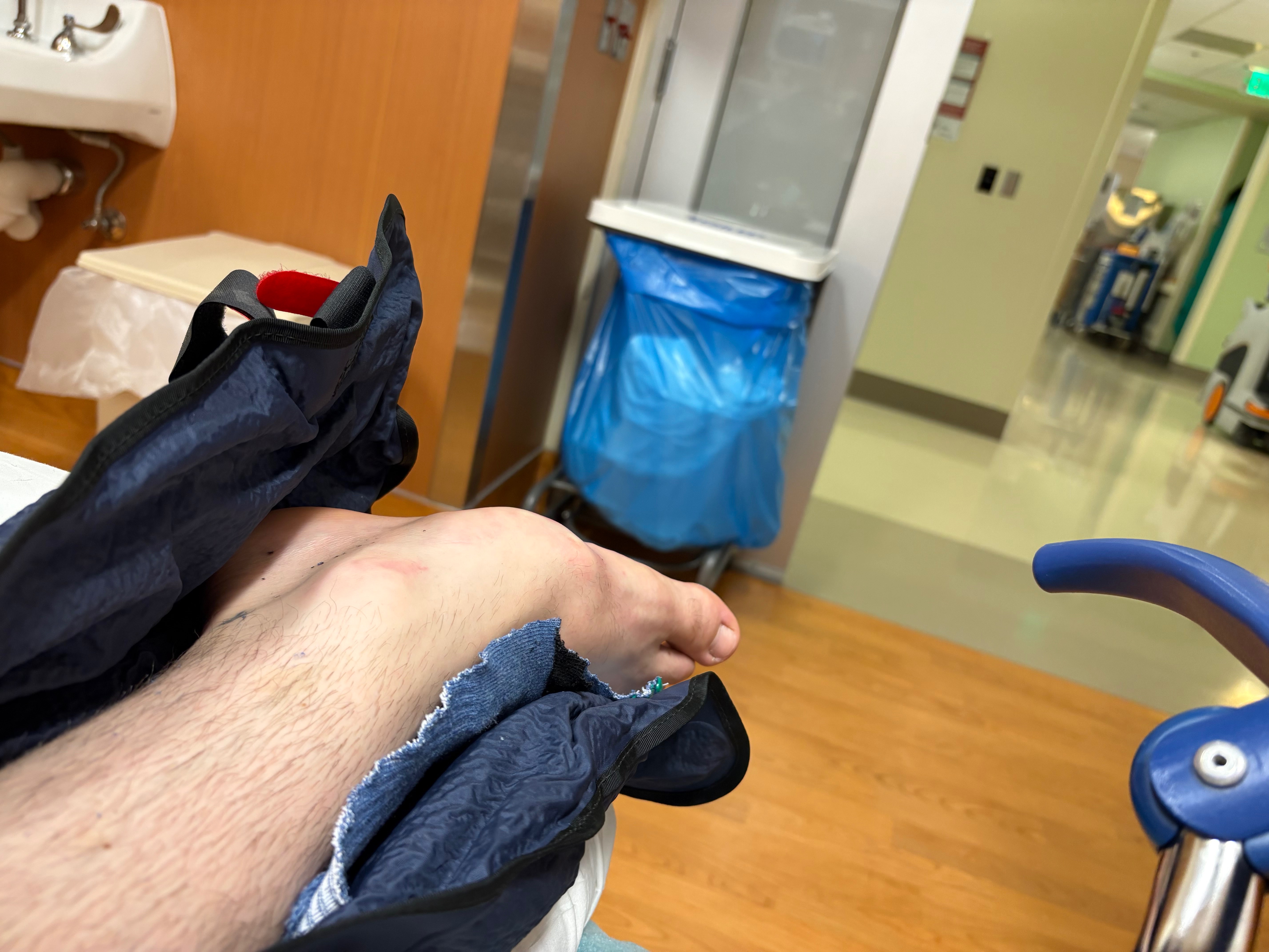 Help 22 Year Old Will Holton Afford Foot Surgery campaign photo, 5 of 8