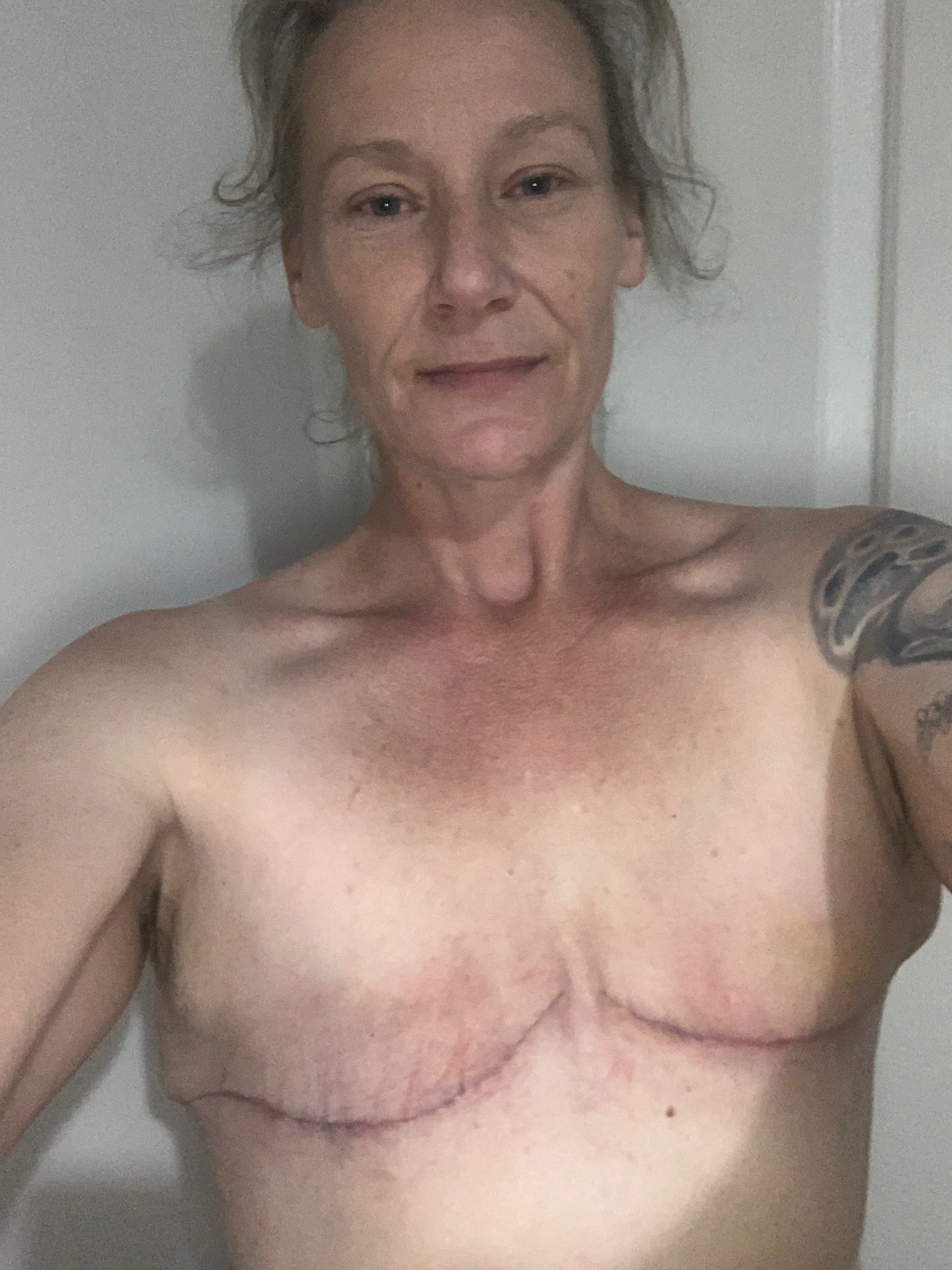 #fuckbreastcancer campaign photo, 4 of 5