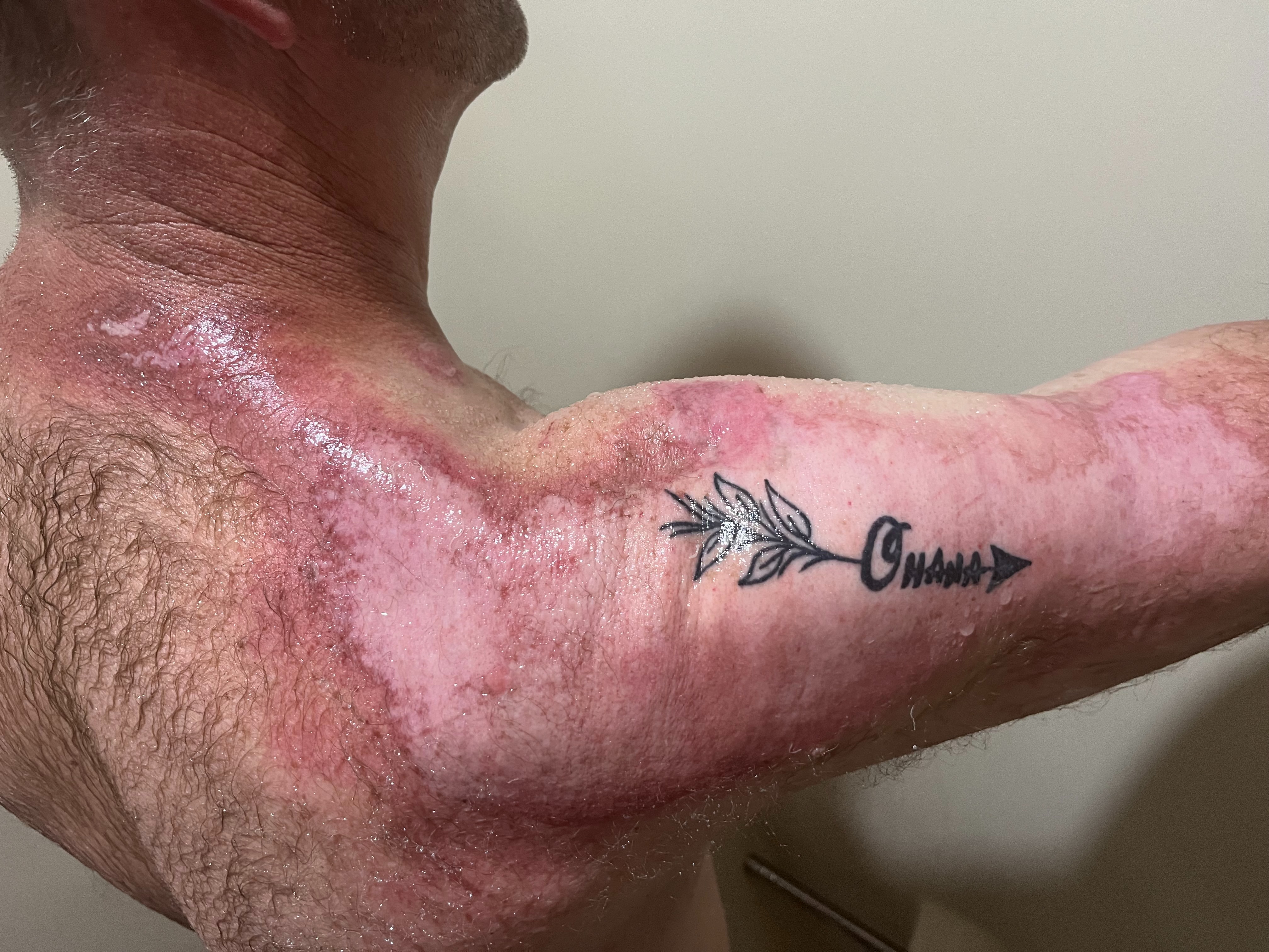 Help David Hess Rebuild After Devastating Fire campaign photo, 5 of 8