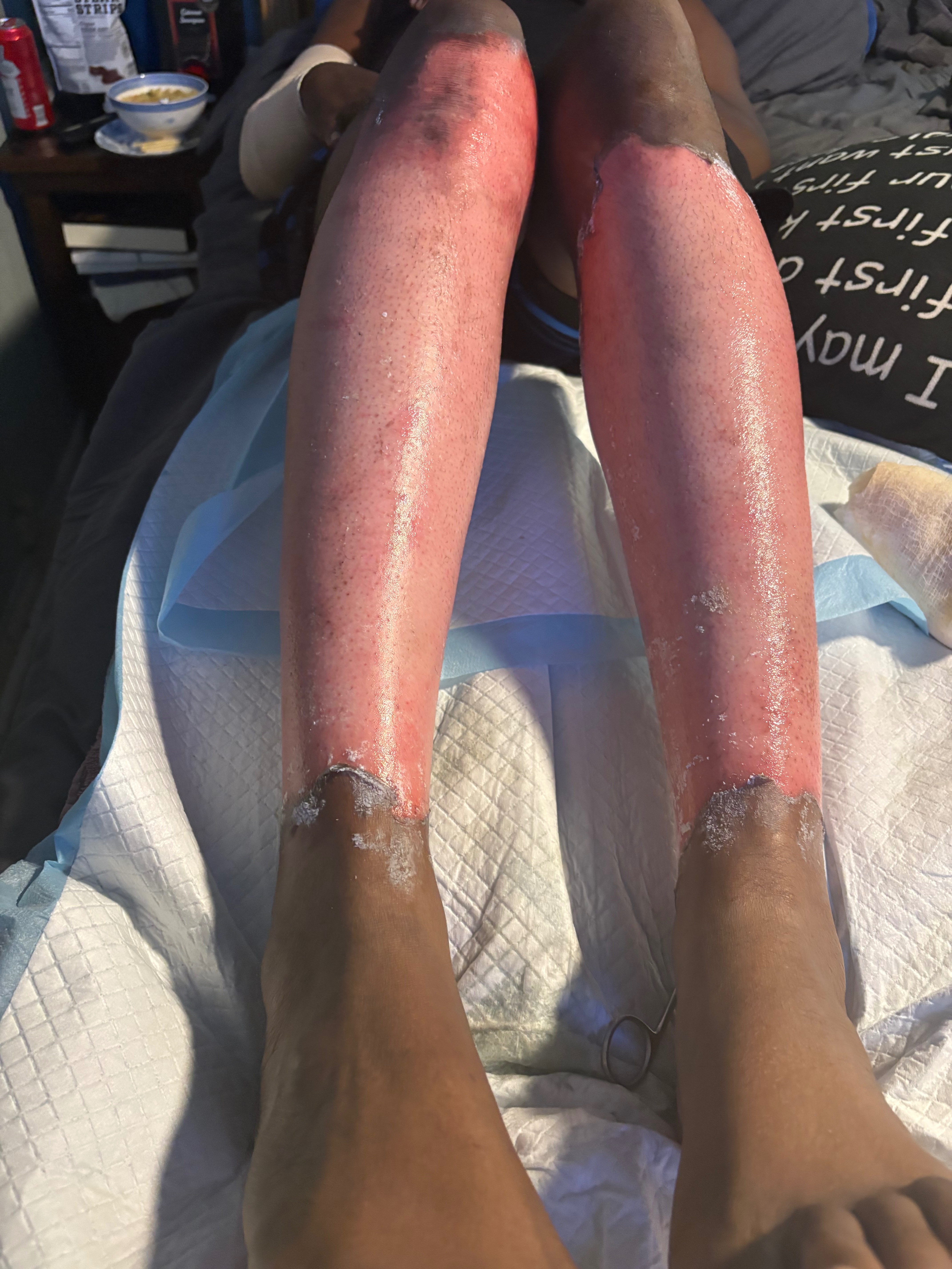 Help Susan’s Family Recover After Tragedy campaign photo, 4 of 8