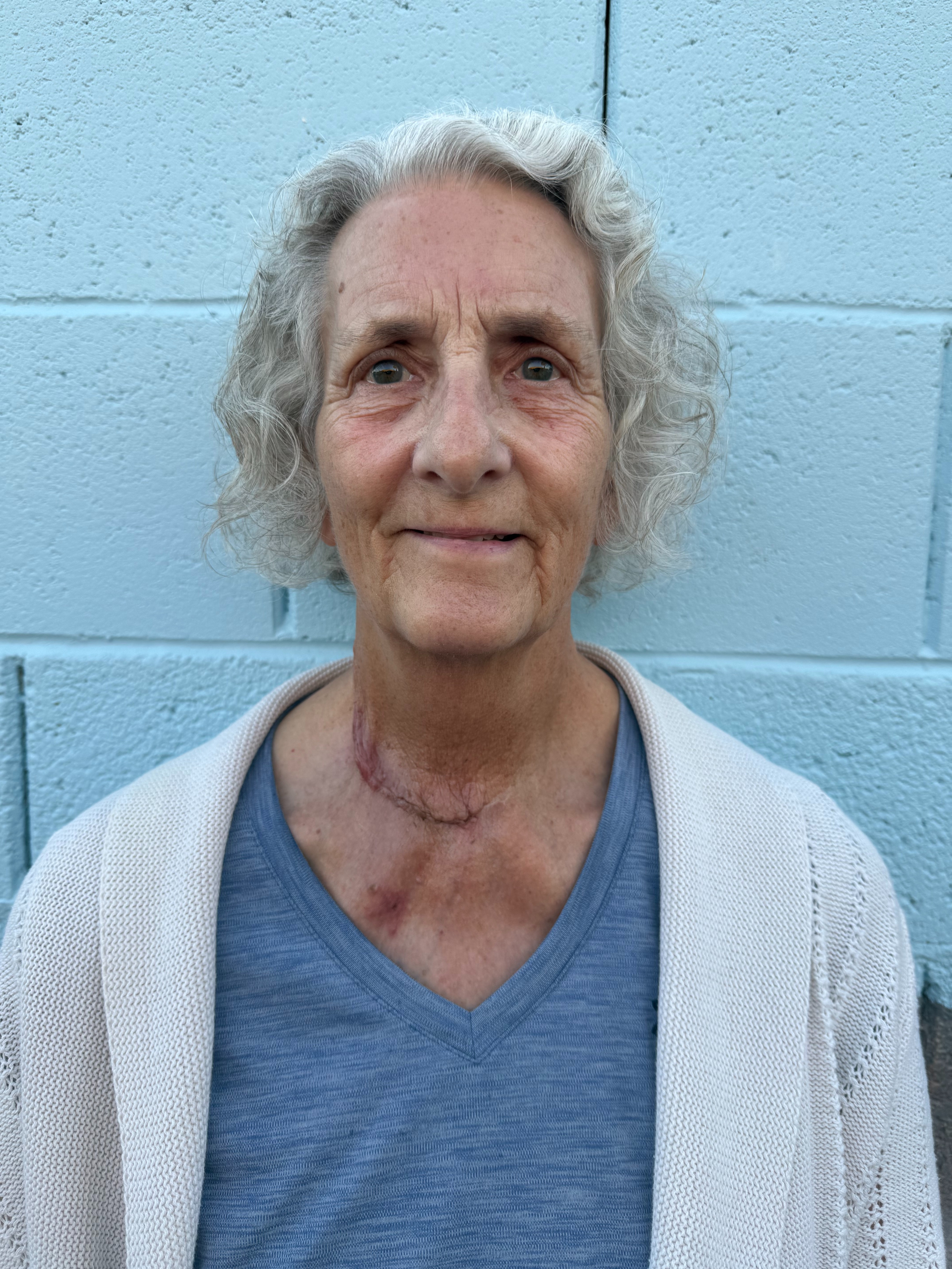Help Deanna Fight Anaplastic Carcinoma campaign photo, 2 of 4